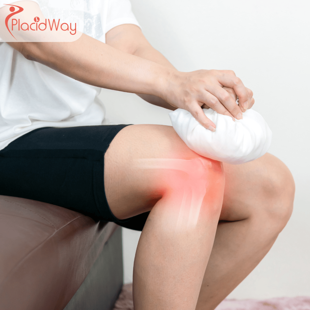 Stem Cell Therapy for Osteoarthritis in Turkey: Costs and Options for UK Patients