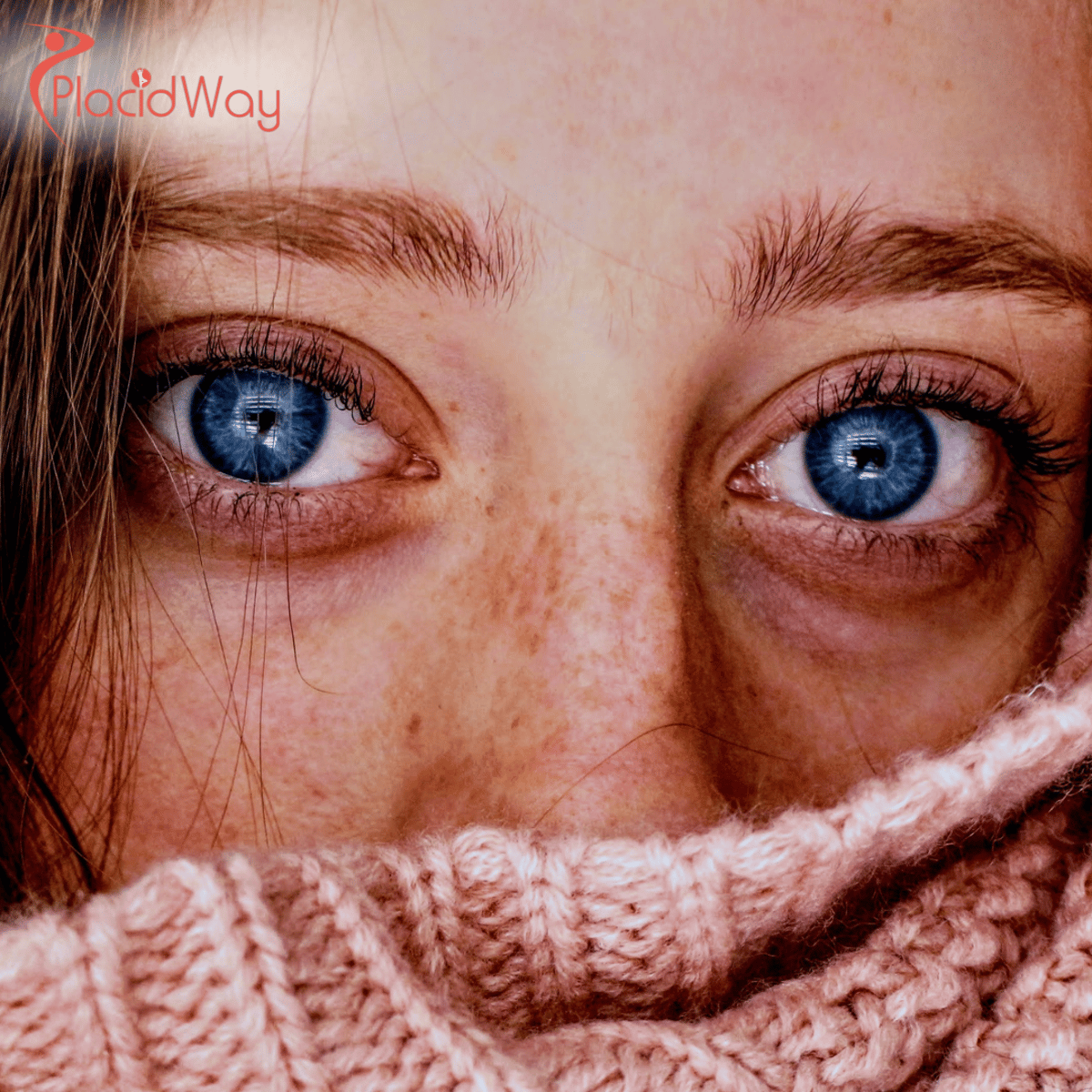 LASIK Surgery in Thailand: A Complete Guide for Australian Patients