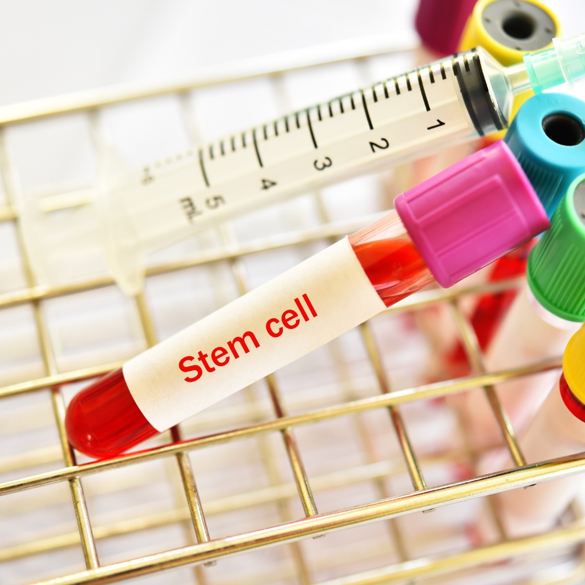 يسافر السنغافوريون إلى الهند لتلقي علاج إطالة العمر المتطور بالخلايا الجذعية