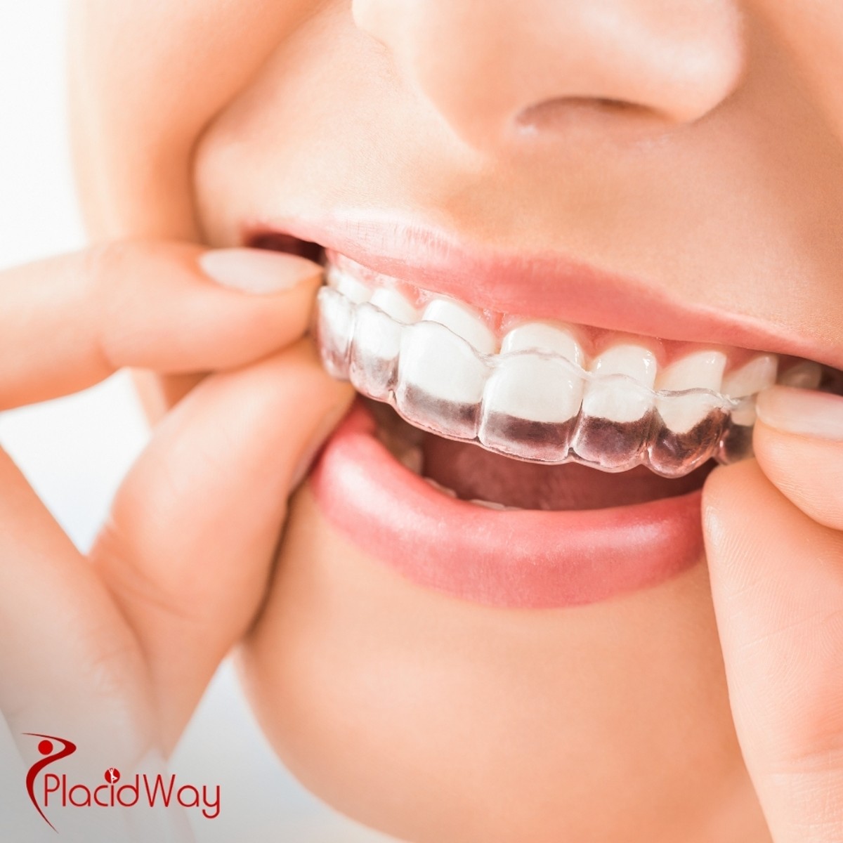 Dental Treatment in South Korea: Explore Costs, Top Clinics, and Procedures