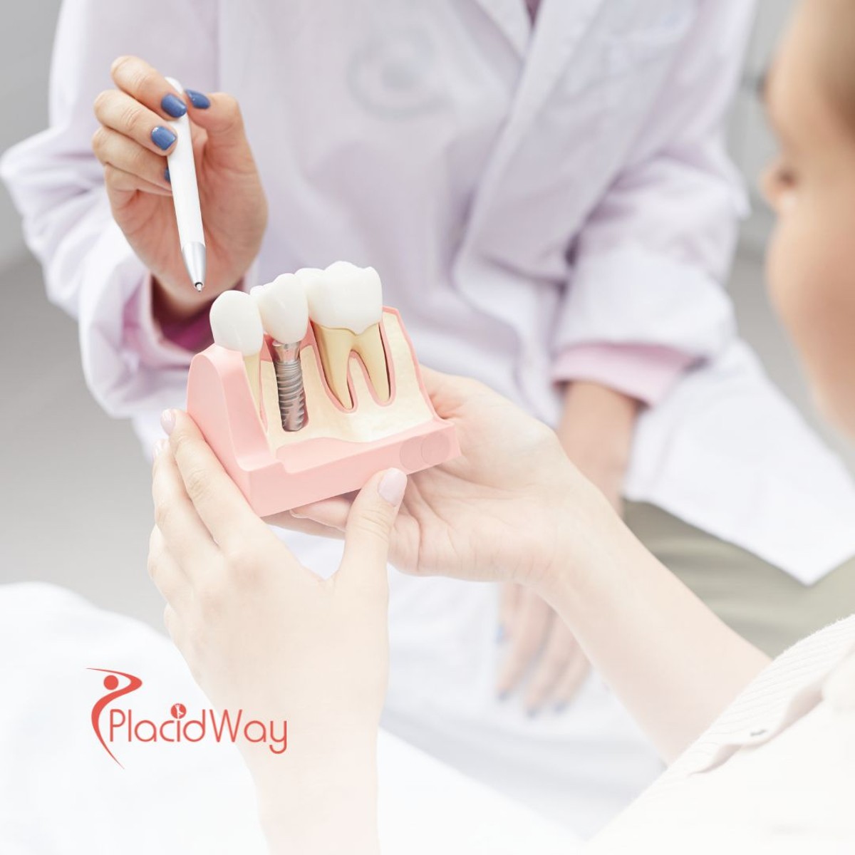 Dental Implants from Toronto to Los Algodones, Mexico – Save Big on Quality Dental Care