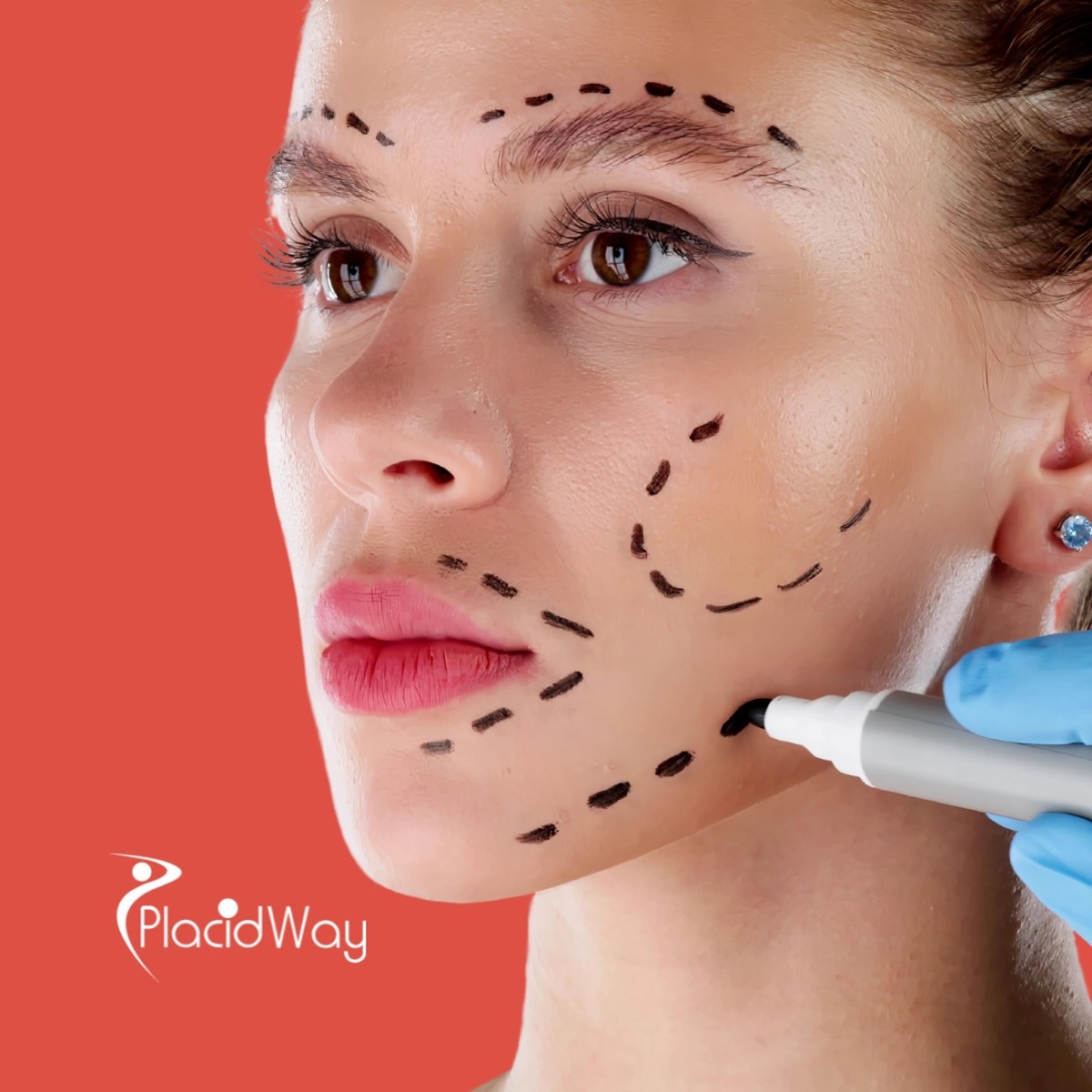 Facelift Surgery in Colombia for Puerto Rican Patients: Transform Your Look with Expert Surgeons