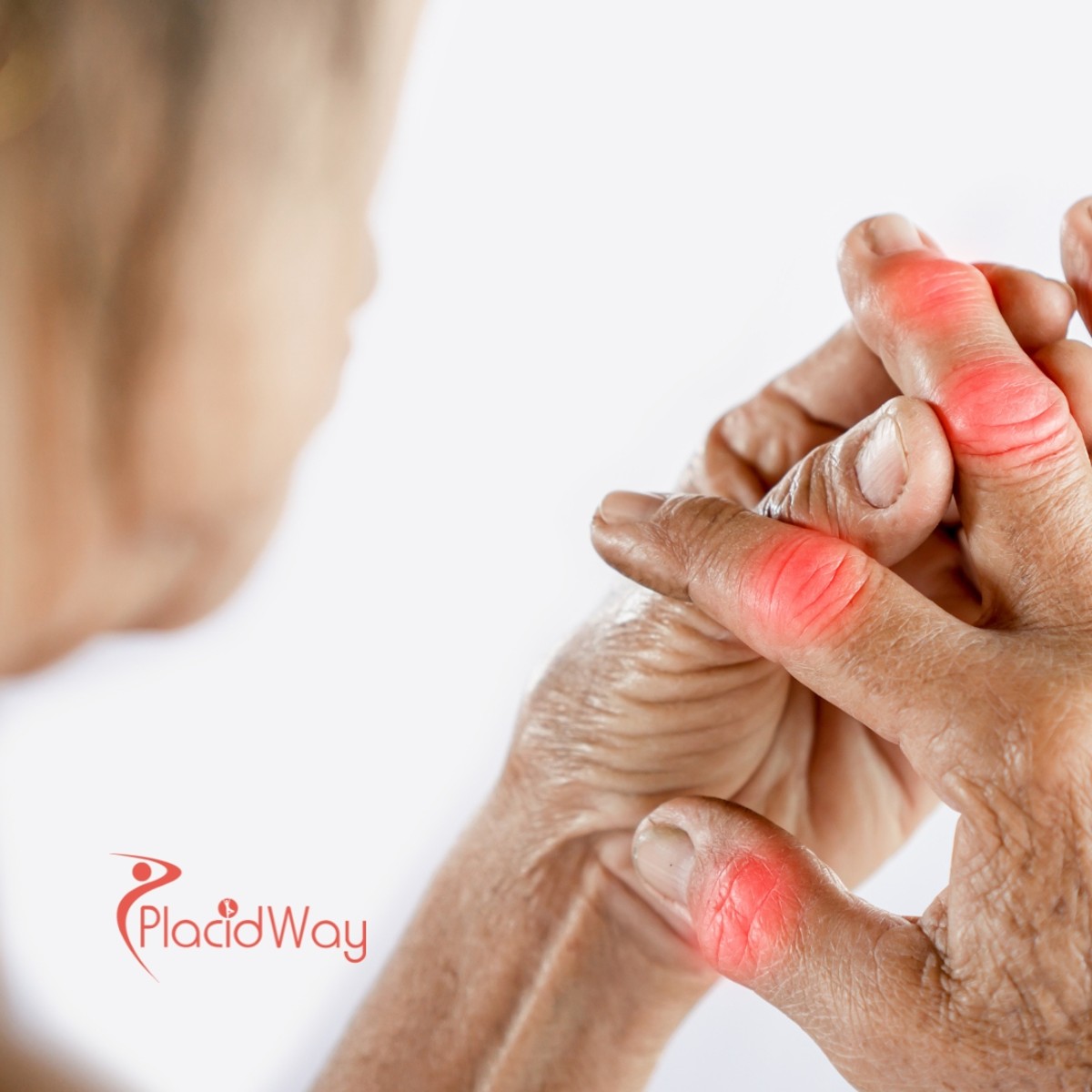 How Stem Cell Therapy in Thailand is Helping New Zealanders with Arthritis