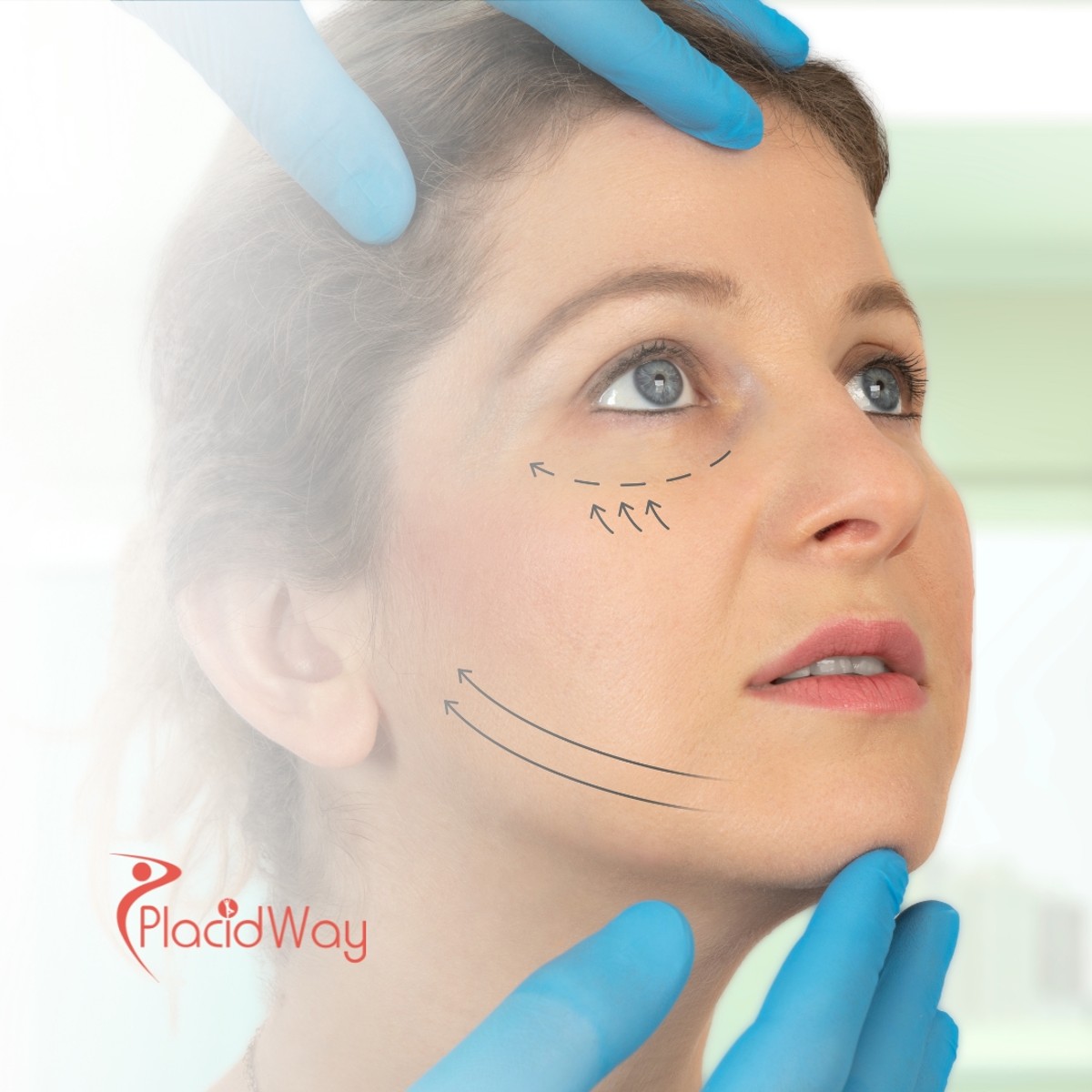 How to Save on Facelift Surgery in Thailand: A Guide for Kiwis