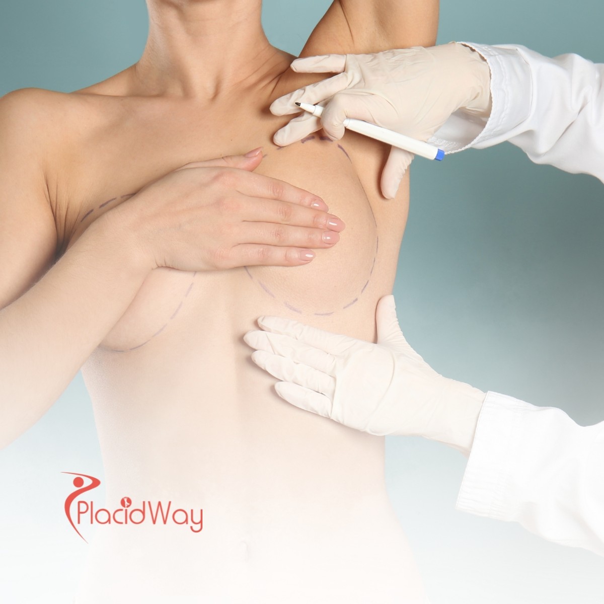 Is Breast Augmentation in Thailand Safe for New Zealanders? Here’s What You Should Know