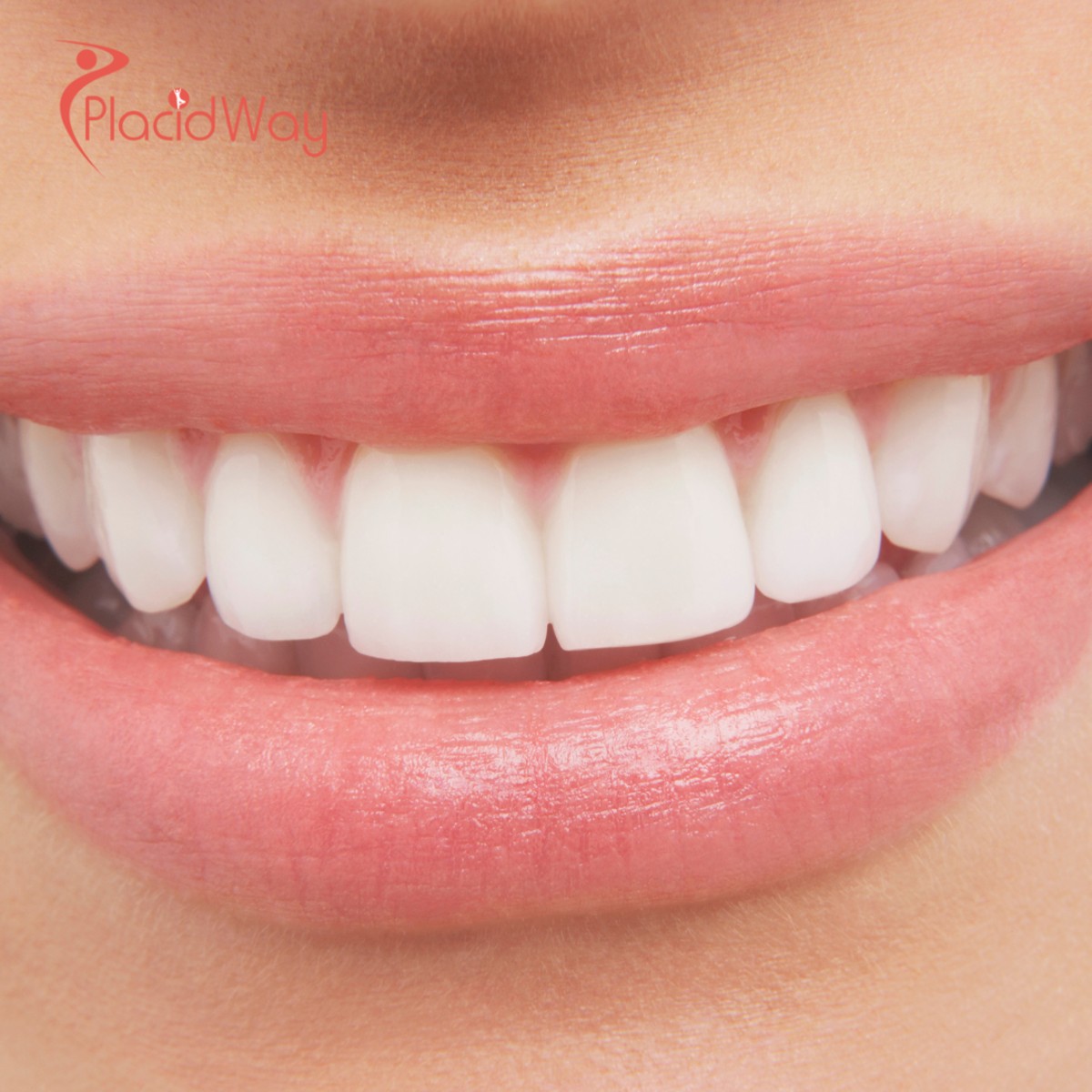 Full Mouth Rehabilitation in Colombia: Get Your Perfect Smile for Less, a Top Choice for Trinidad and Tobago Residents