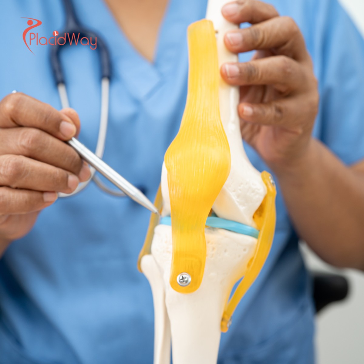Stem Cell Treatment for Osteoarthritis in Thailand: Costs, Clinics & Procedure Guide