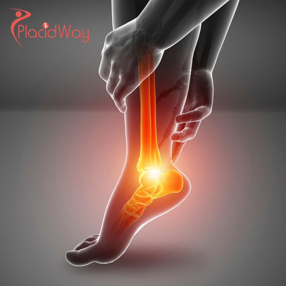 Orthopaedic Stem Cell Therapy in Colombia: The Definitive Guide to Regenerative Joint Health