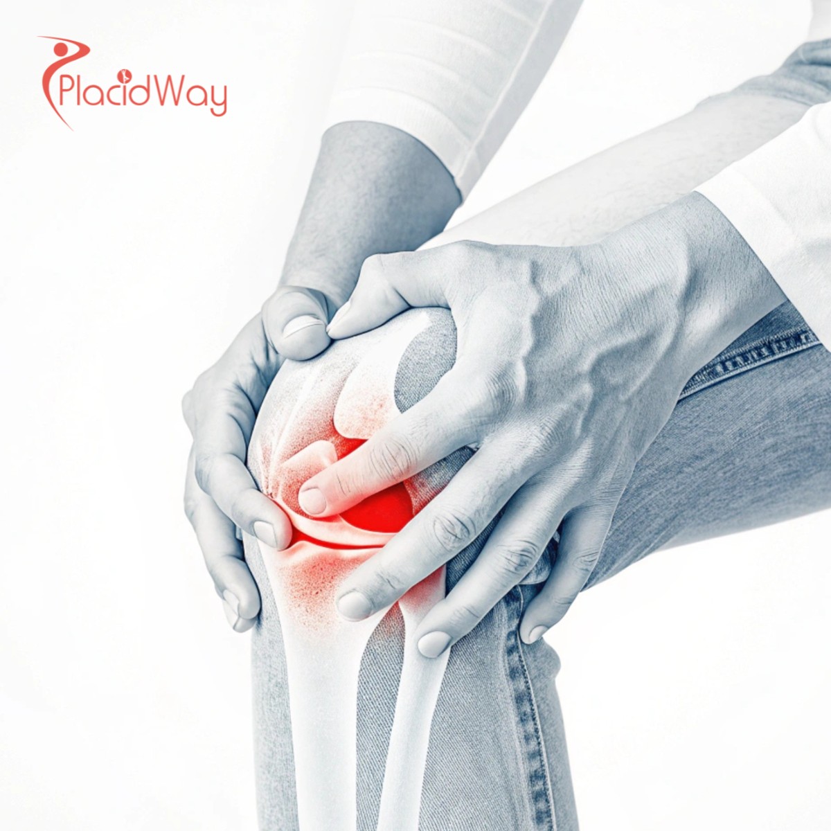 Joint Treatment Stem Cell Colombia: Costs, Clinics & Success Rates