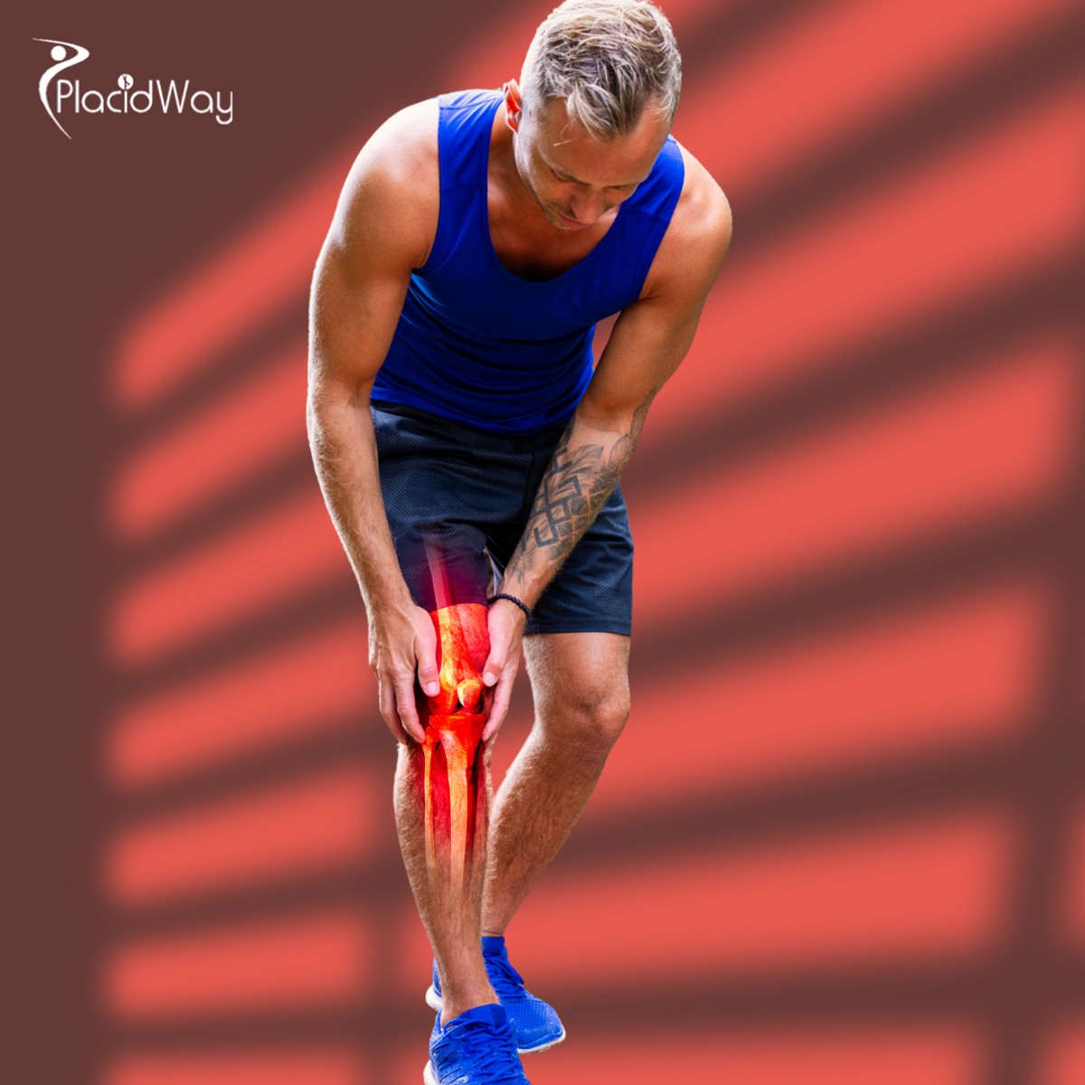 Osteoarthritis Stem Cell Therapy in Mexico for Patients from Central America Seeking Relief and Renewal