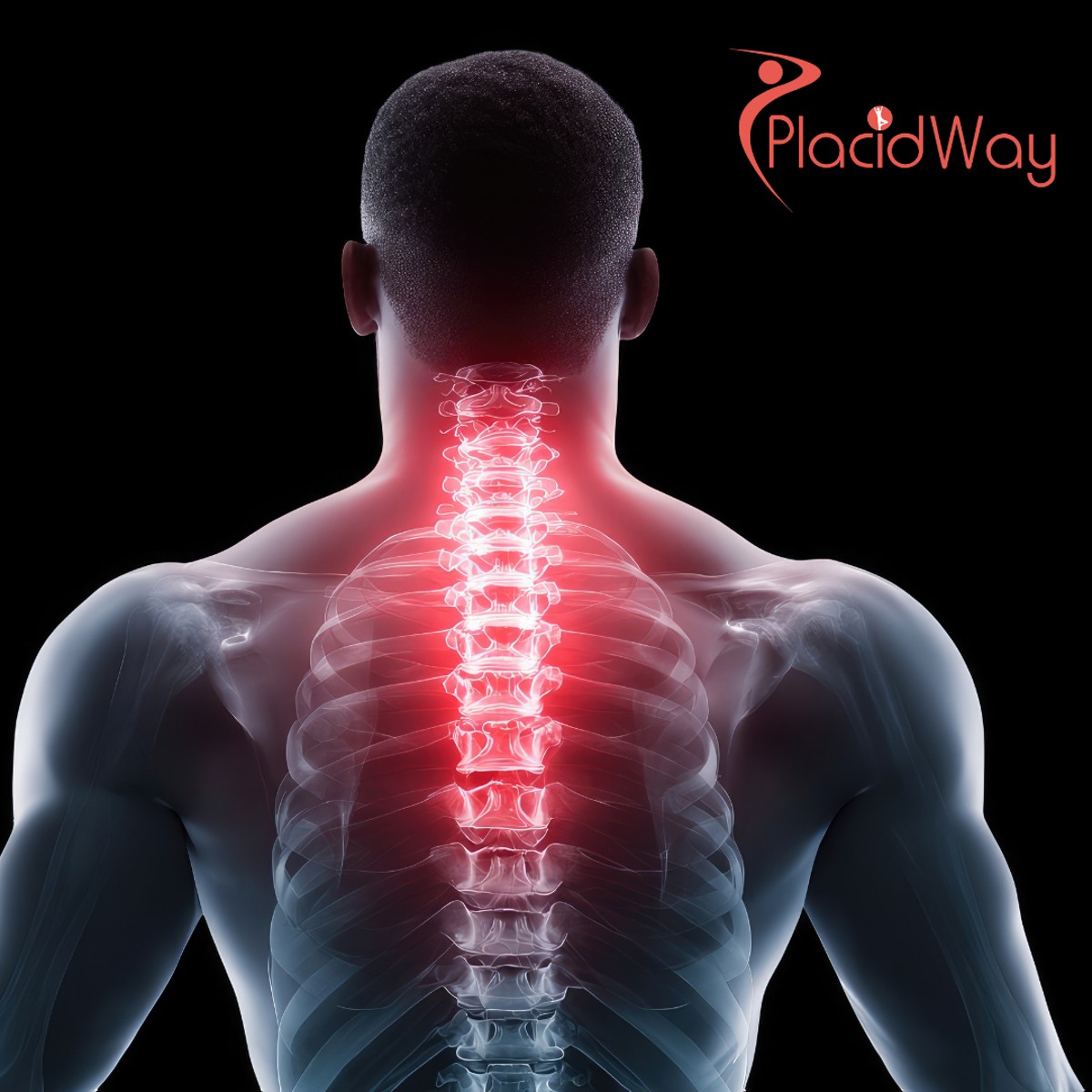 Stem Cell Therapy for Back Pain in Thailand for US Patients With Chronic Spine Issues