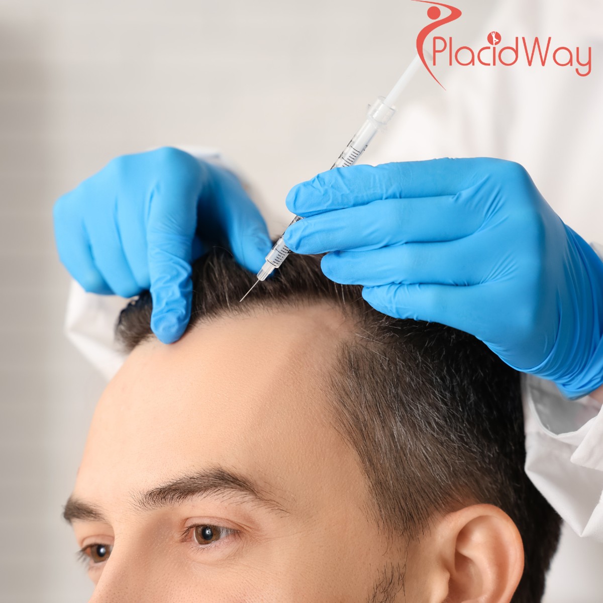 DHI Hair Transplant in Turkey for American Professionals