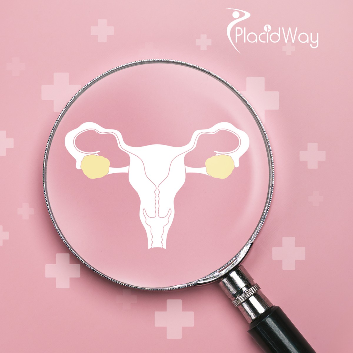 Advanced Ovarian Cancer Treatment in Tijuana - New Hope for Cancer Patients