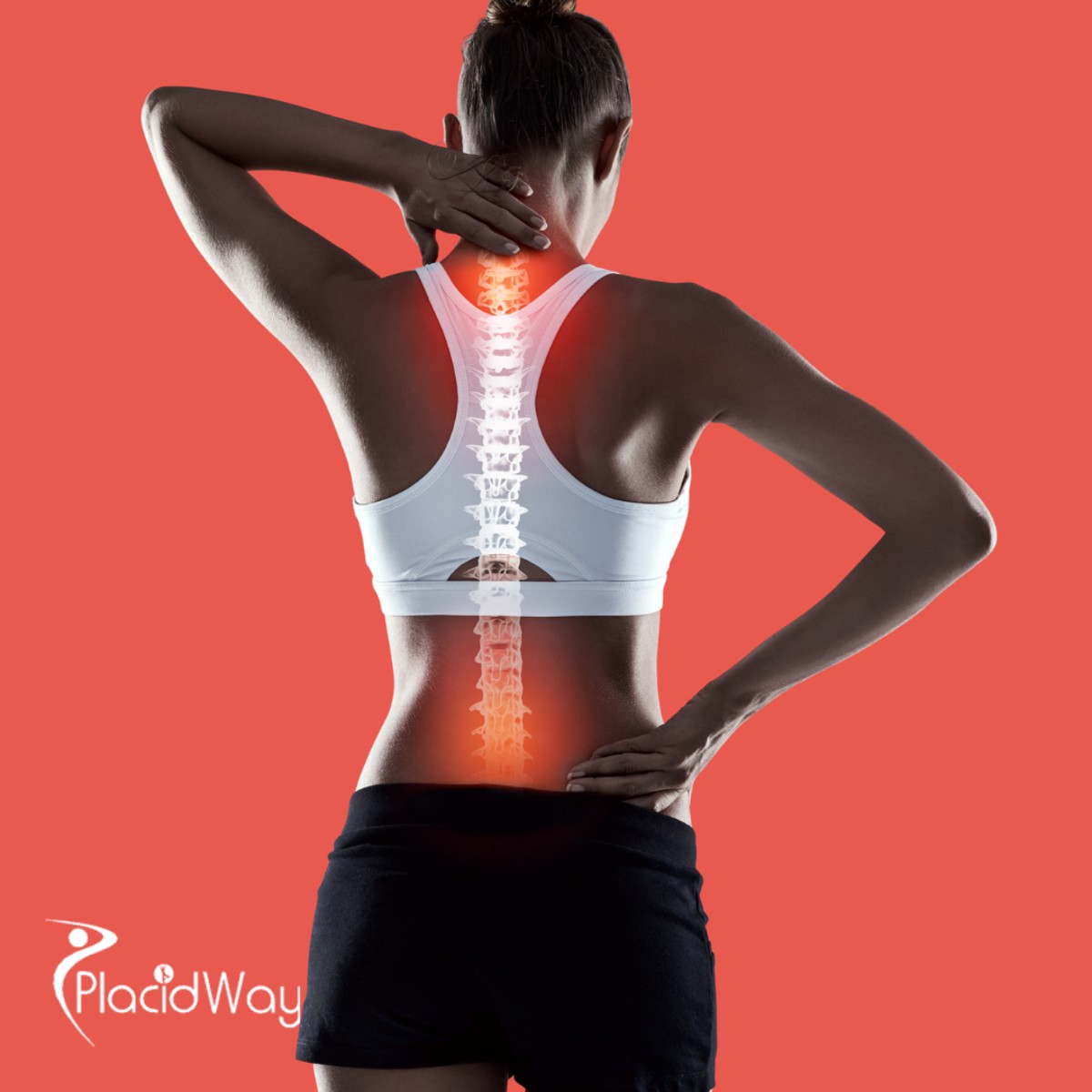  Advanced Spine Surgery in India for Patients Requiring Complex Spinal Care