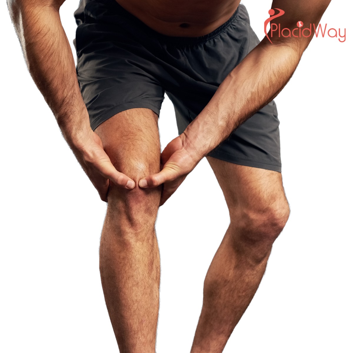 6 Things to Know About ACL, Meniscus & Sports Surgery in Tijuana