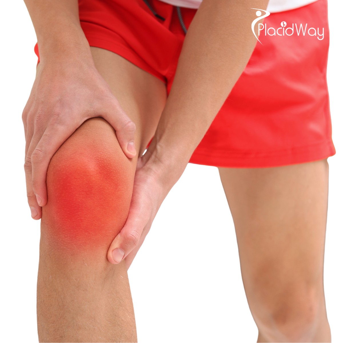 Stem Cell Therapy for Knee Osteoarthritis in Japan: A Regenerative Option for Pain and Mobility