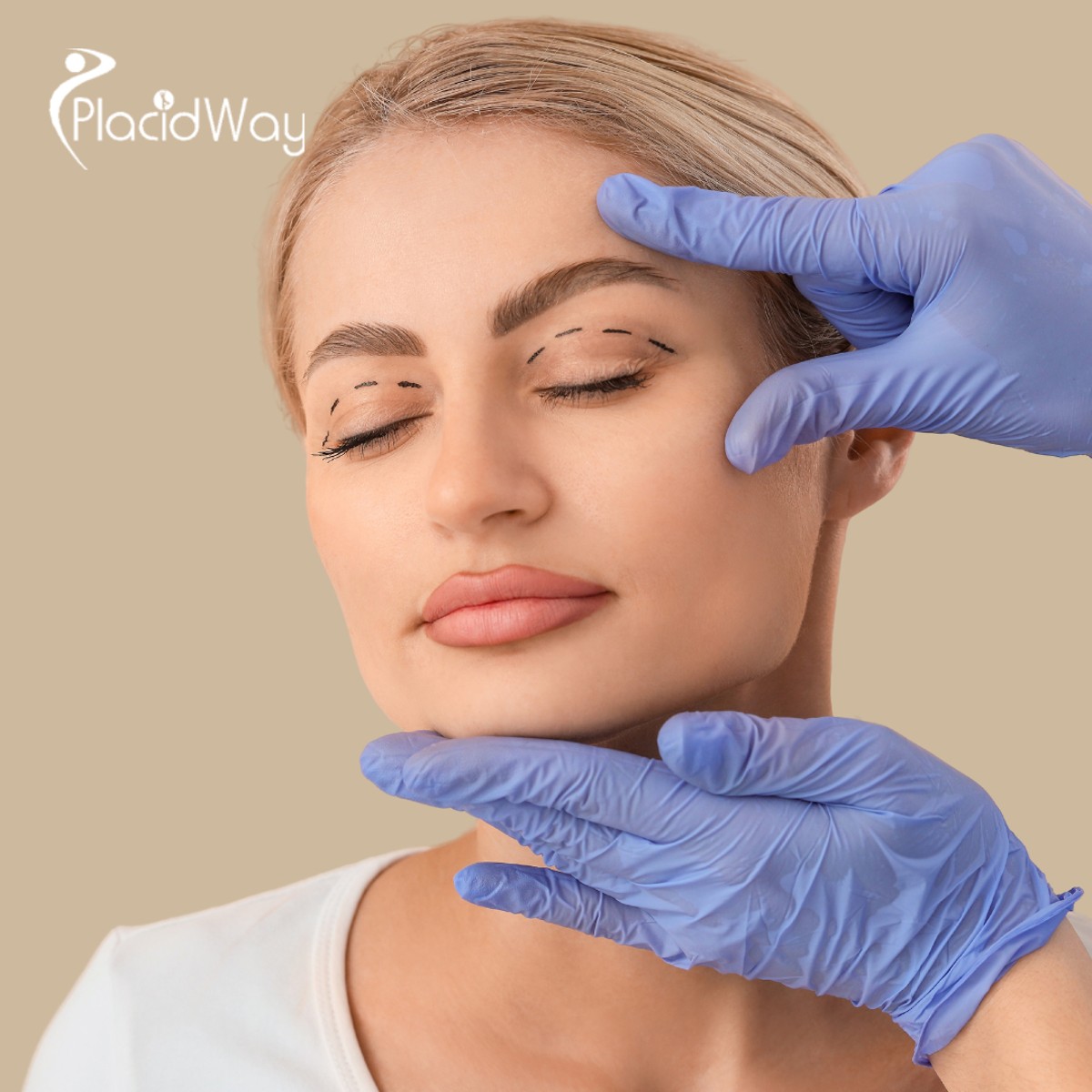 Why Japanese Millennials are Flocking to South Korea for Natural-Look Double Eyelid Surgery in 2026