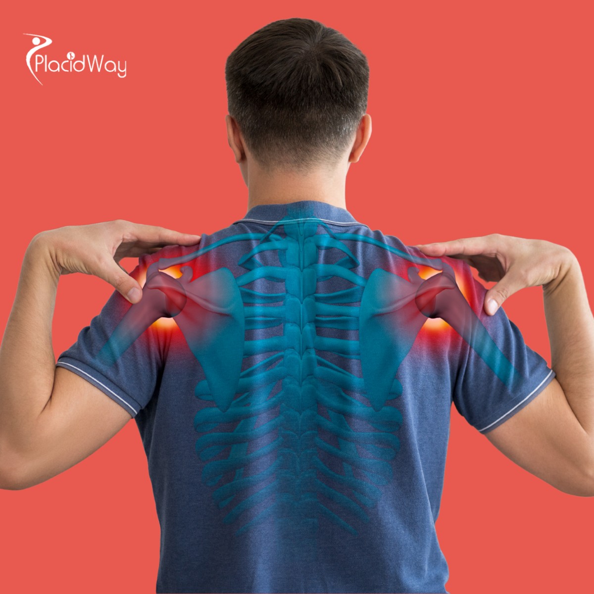 Healing in the Tropics: Why Cancun is the Preferred Choice for Canadian Athletes Needing Shoulder Surgery