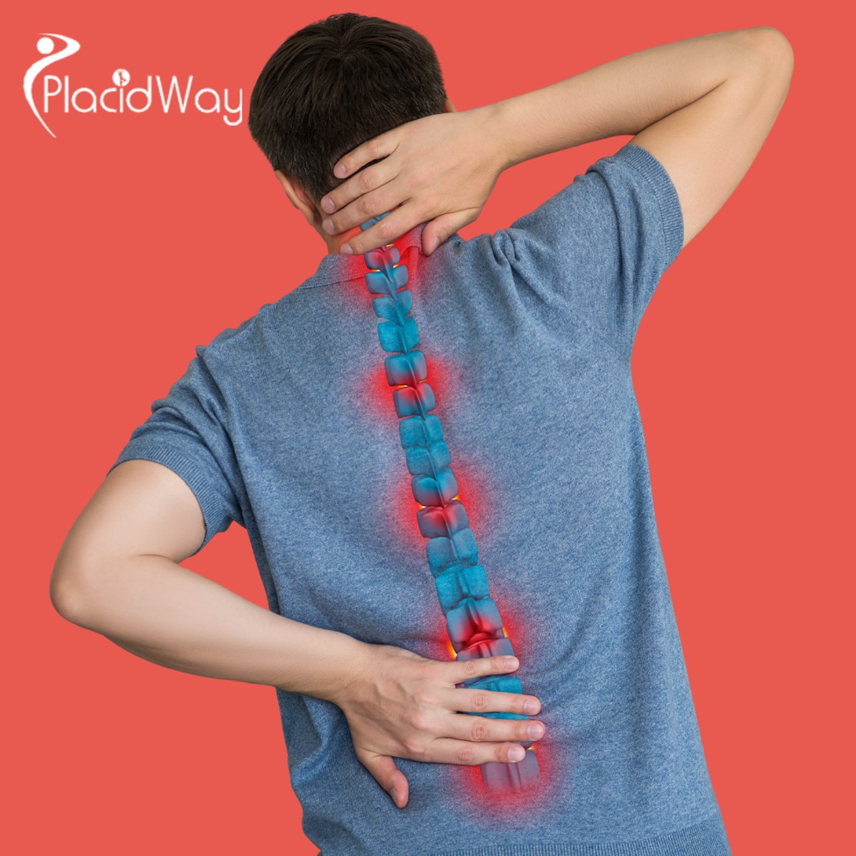 Filipinos Are Finding Spinal Arthritis Relief with Stem Cells in Tokyo