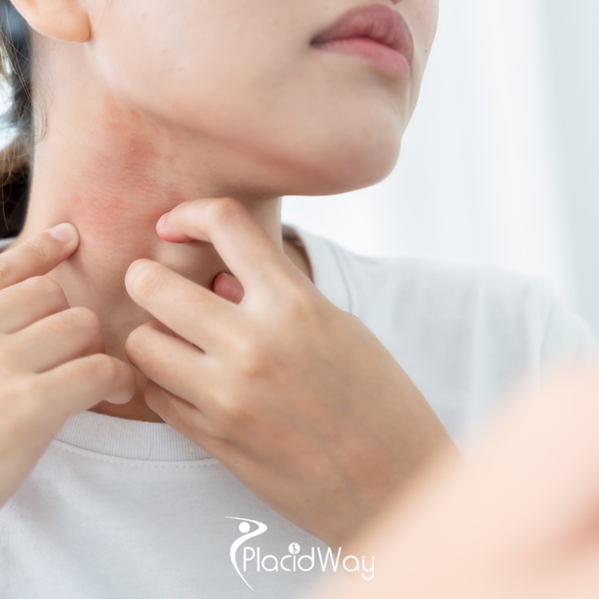 Lupus? Stem Cells in Mexico Are Helping U.S. Patients Turn Their Lives Around!