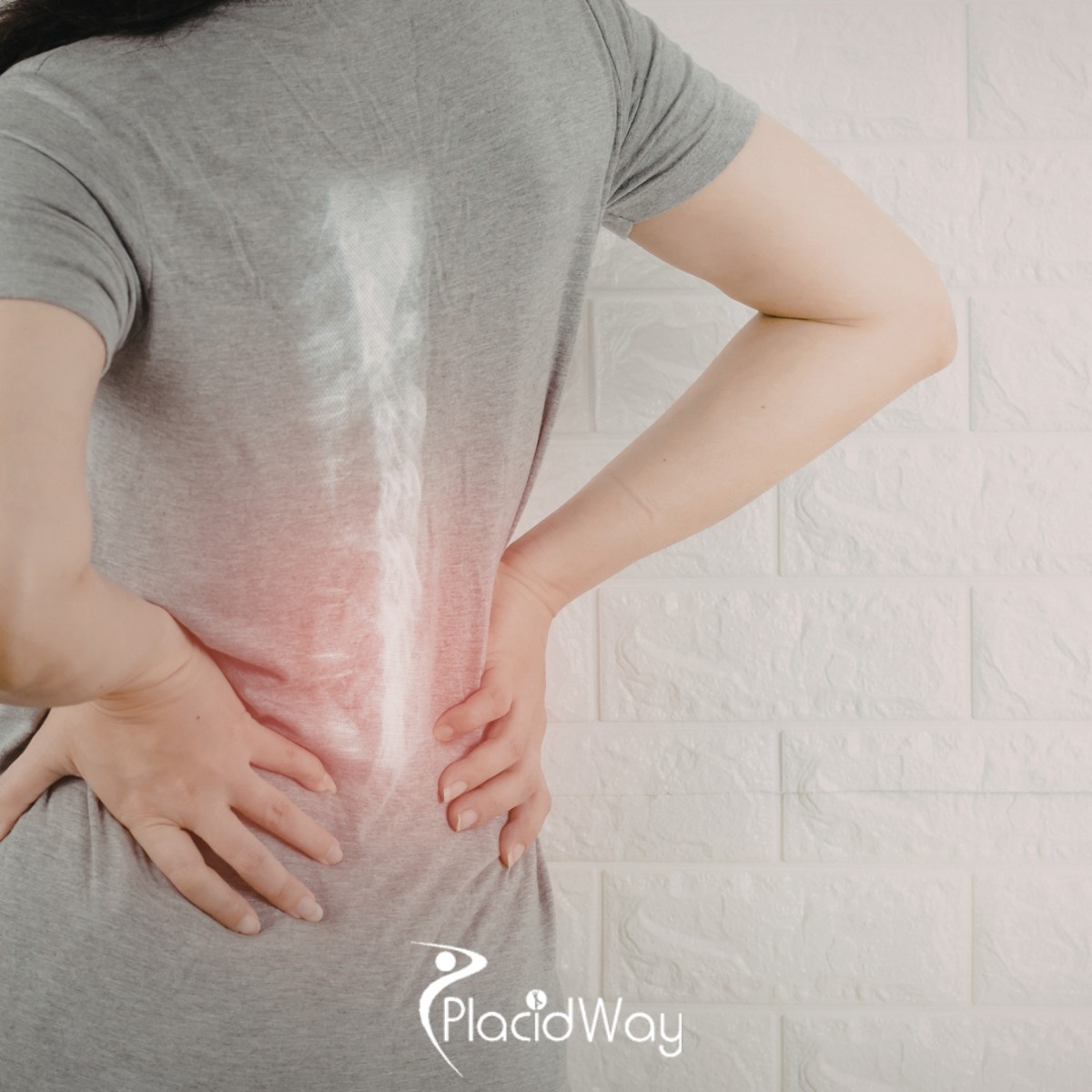 Patients Are Finding Relief from Back Spine Injuries with Stem Cells — A Non-Surgical Solution in Mexico City