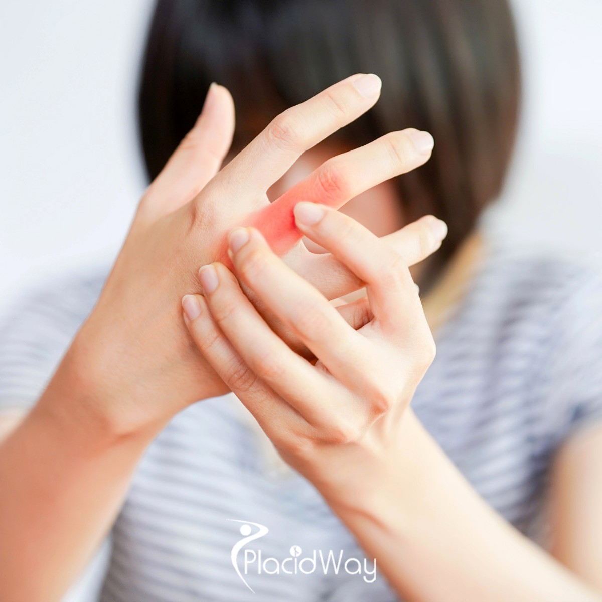 Stem Cells for Autoimmune Diseases: Vietnamese Are Trusting Osaka for Groundbreaking Treatment