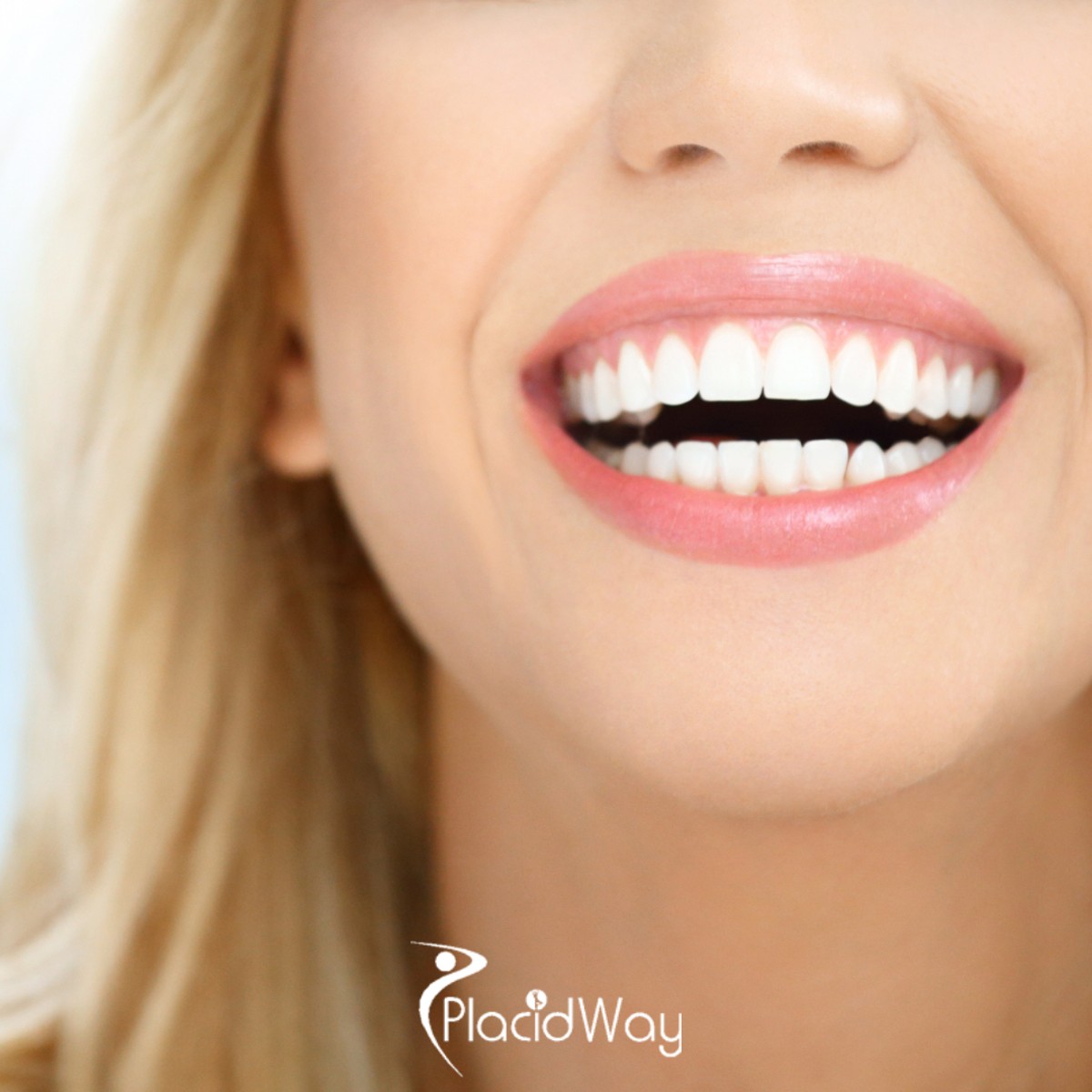The 'Saigon Smile': How 2026's AI-Powered Digital Smile Design is Attracting a Record Number of UK and European Patients Seeking Hollywood Veneers