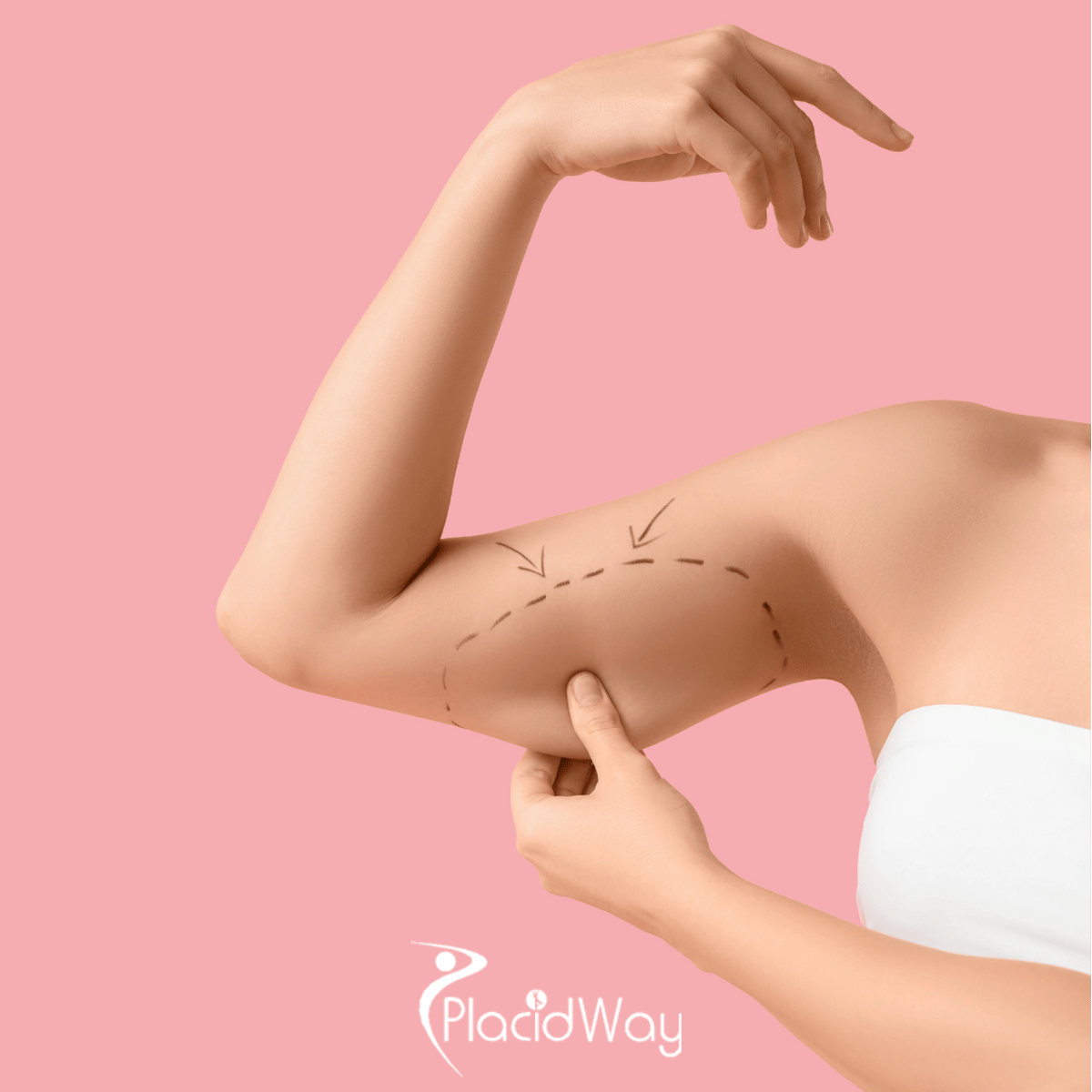 High-Tech Body Contouring: Why Guadalajara is Leading the VASER Liposuction Boom in 2026
