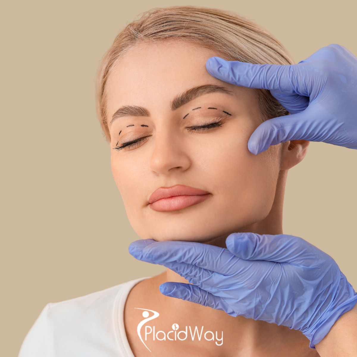 The Subtle Refresh: Why Guadalajara is the Go-To Hub for Quick-Recovery 'Fox Eye' and Eyelid Surgeries