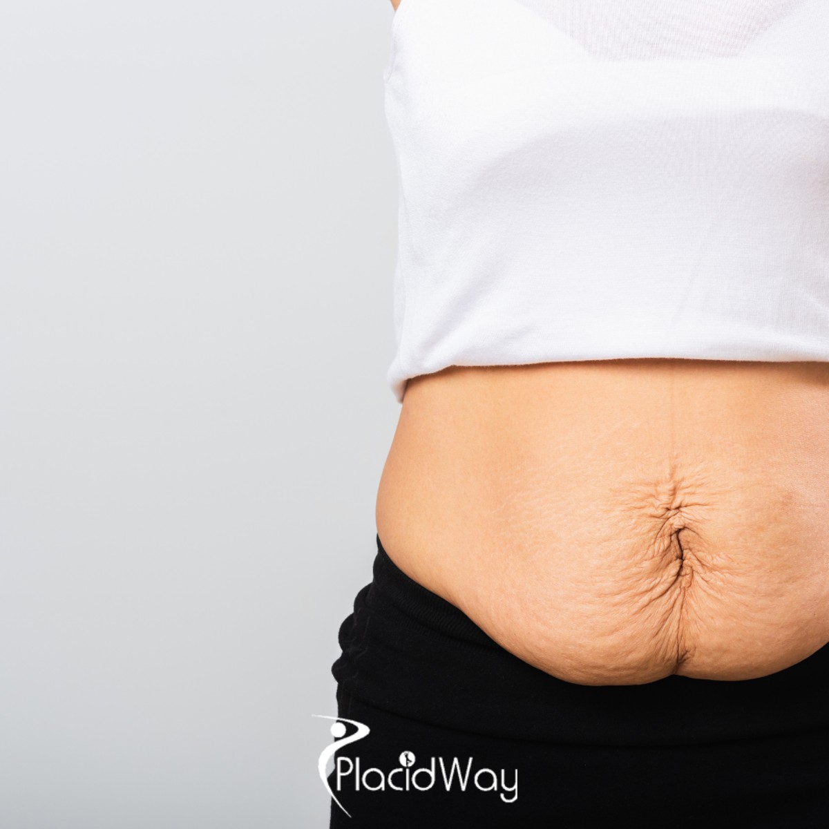 Tummy Tuck in Mexico vs USA - How American Moms Are Avoiding $12,000 Surgical Bills