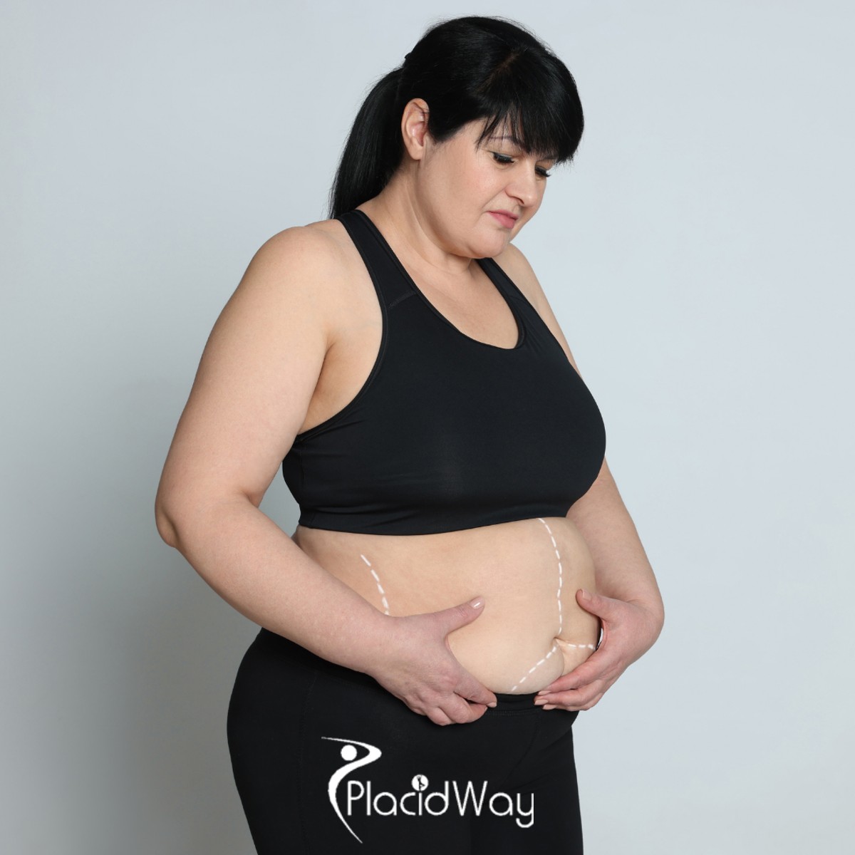 Gastric Sleeve in Turkey vs Spain - Comparing €4,000 All-Inclusive Packages for Irish Seekers, Brands, and Quality Standards Compared