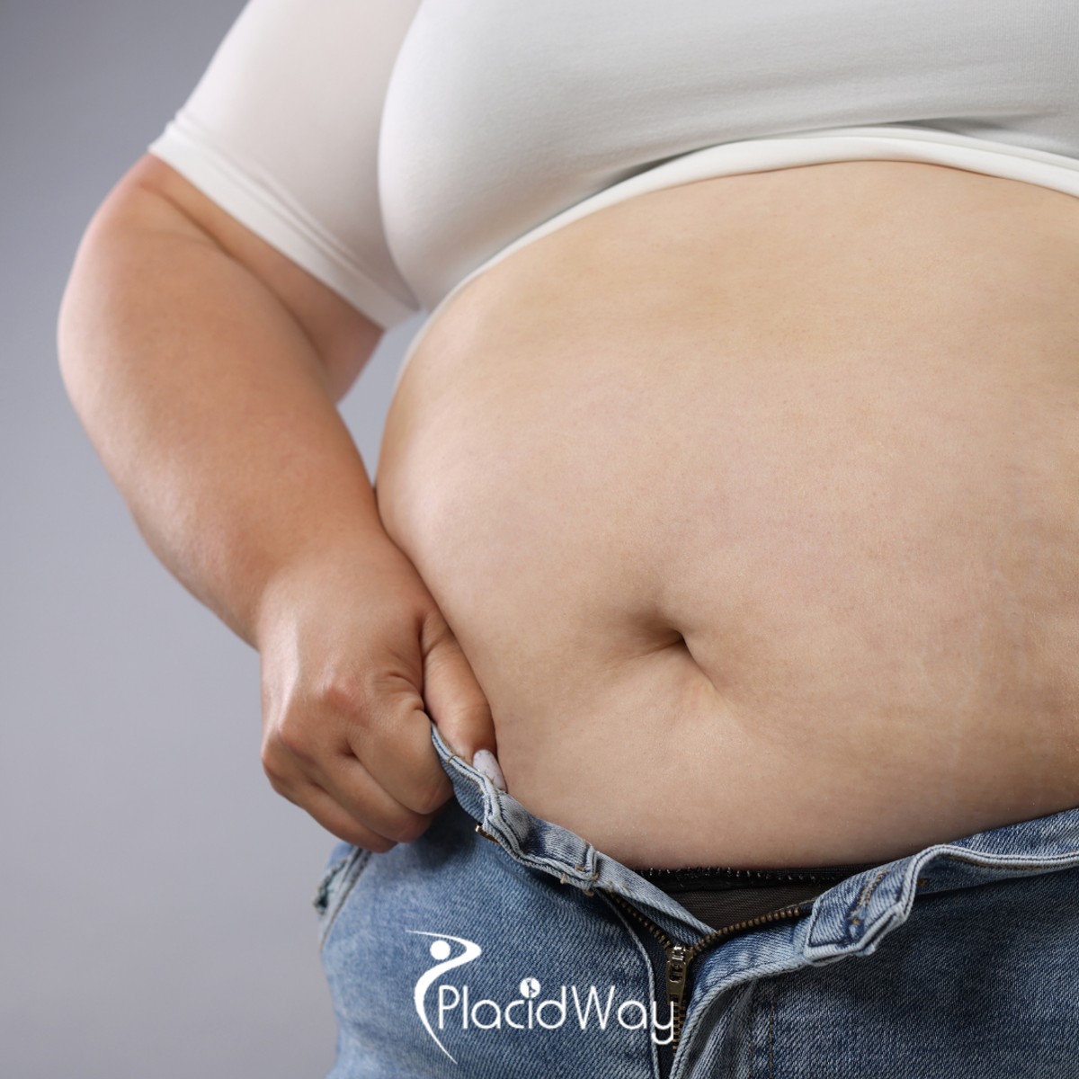 6 Proven Benefits of Roux-en-Y Gastric Bypass in Mexico for Diabetic Texans
