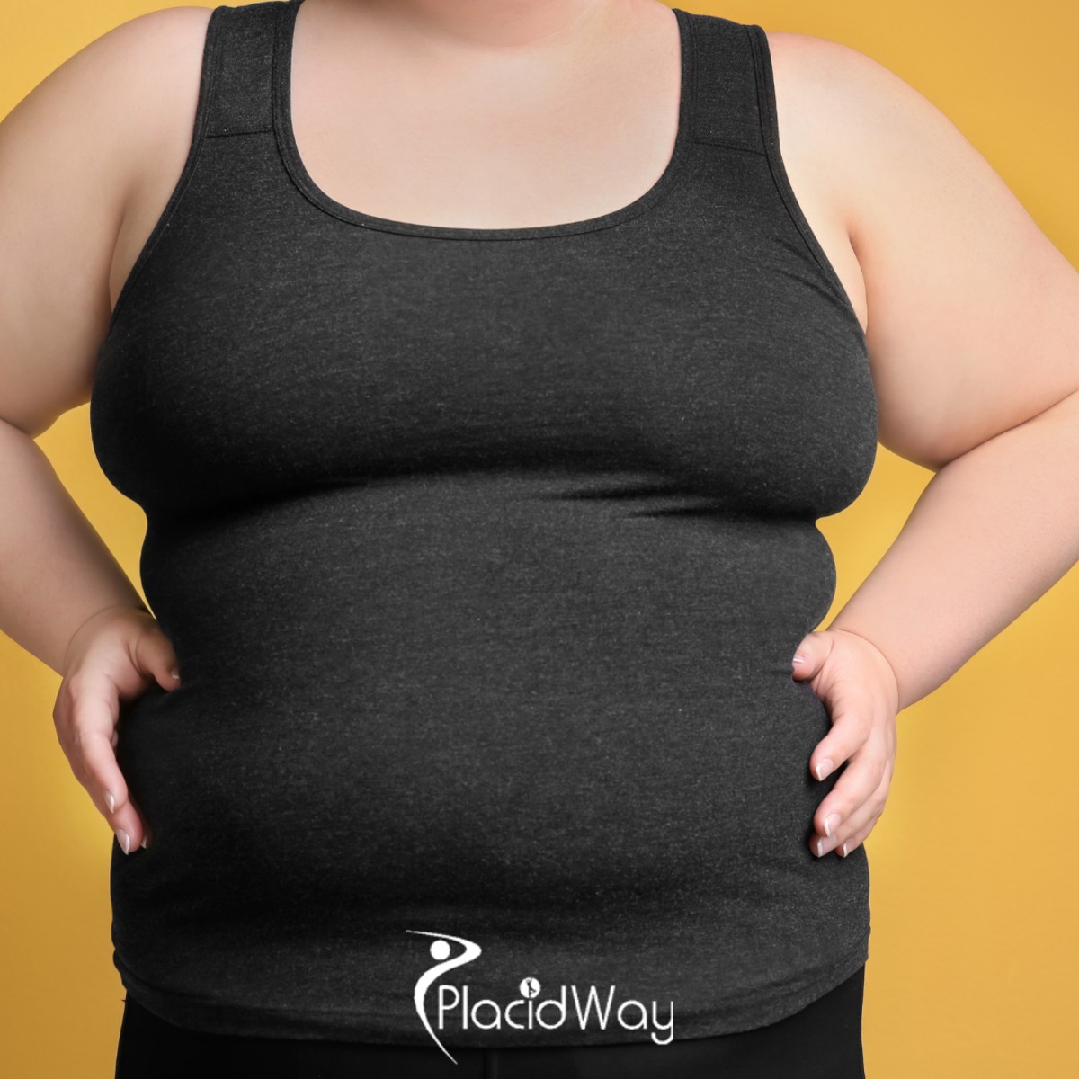 8 Recovery Tips for American Patients Undergoing Duodenal Switch in Piedras Negras