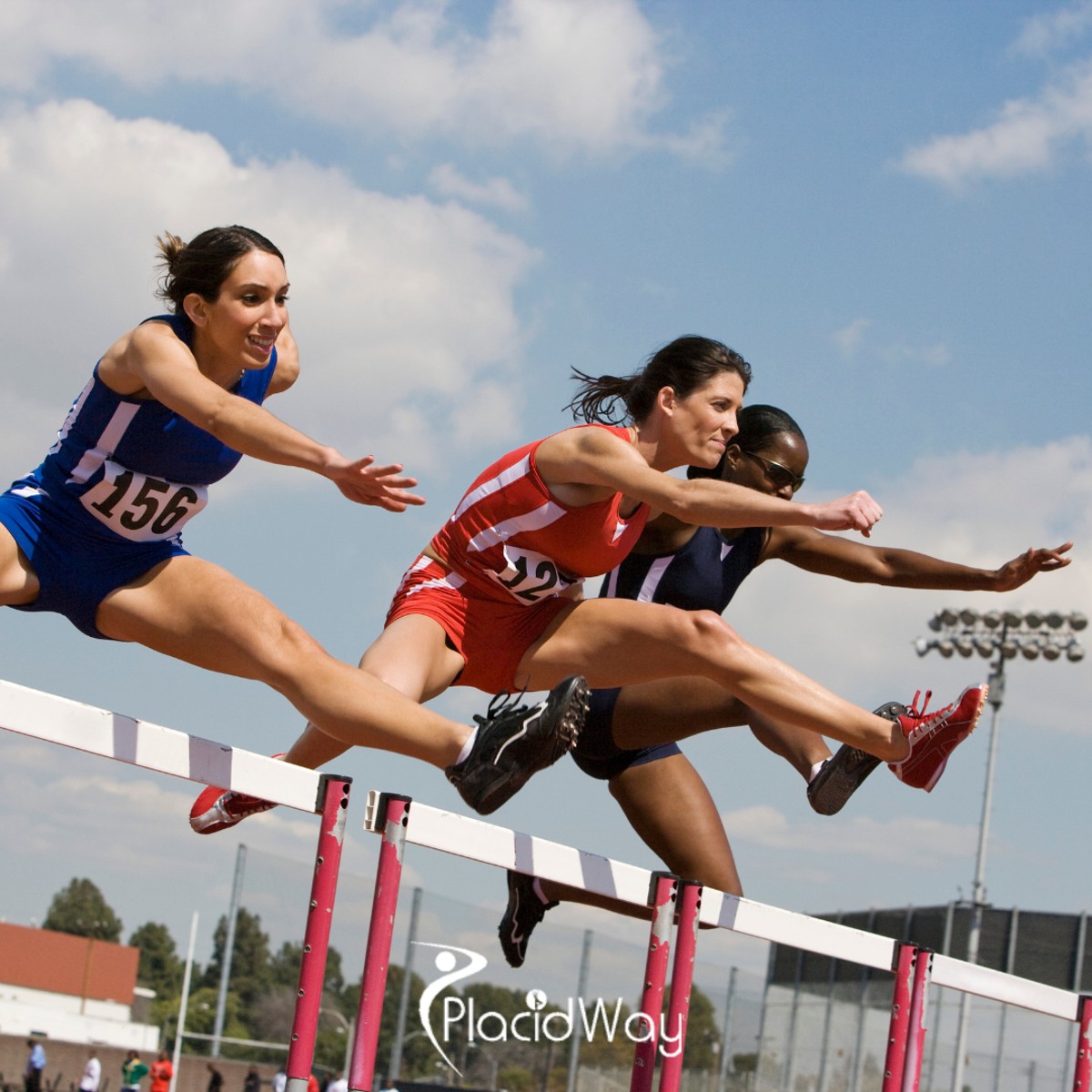 5 Reasons US Athletes Choose Stem Cell-Assisted Meniscus Repair in Mexico