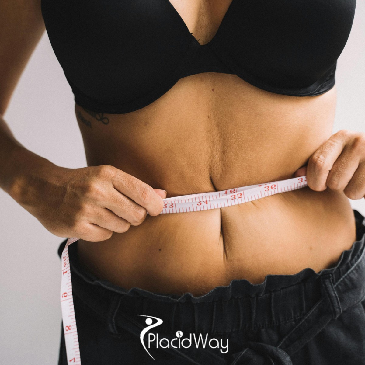 7 Reasons UK Patients Are Switching from Sleeve to Roux-en-Y Gastric Bypass in Istanbul