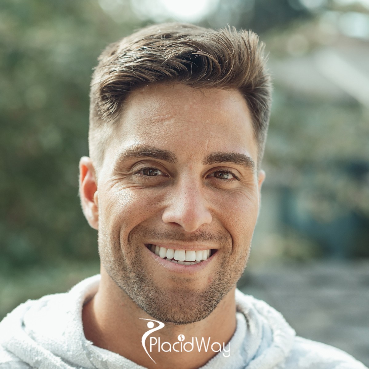 Restoring Confidence: How Cali’s All-on-4 Packages are Saving Americans $40,000 on Full-Mouth Restorations