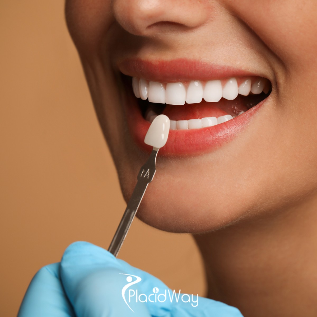 The Urban Glow-Up: Why Zagreb is the Hub for Ultra-Thin, Natural-Looking Veneers