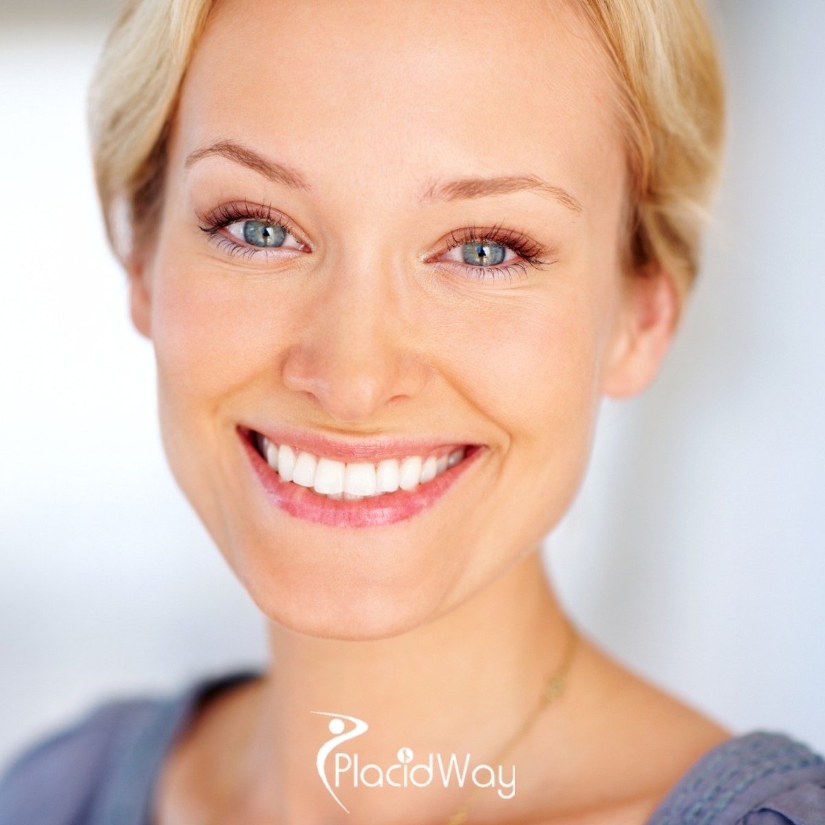 Why 2026 Trends in Alexandria Favor Ultra-Thin & No-Prep Porcelain Artistry?