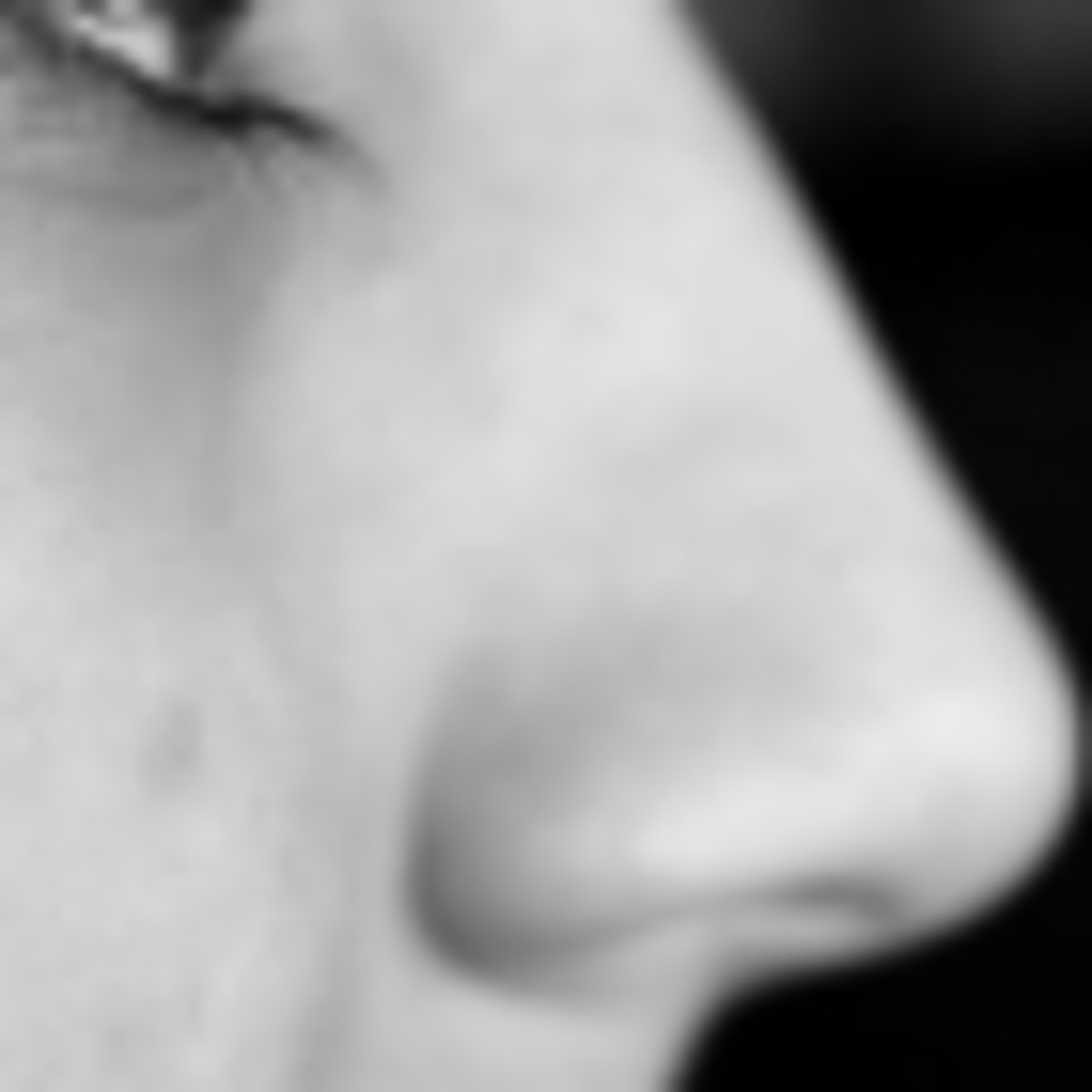 Nasenkorrektur in Zagreb, Kroatien, Kosten, Kliniken, Chirurgen