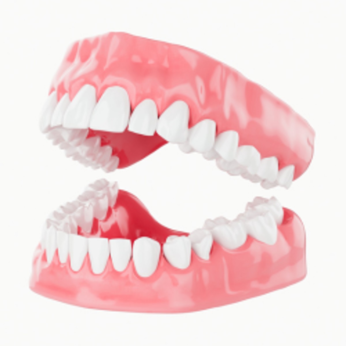 Implantes Dentales En Mexico Precios - 2025