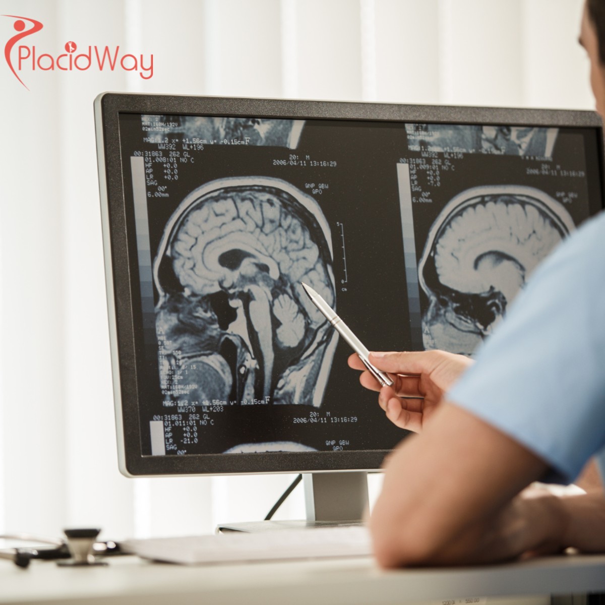 Tumor Padat dan Sel T CAR: Bisakah Terapi Ini Berfungsi di Luar Kanker Darah?