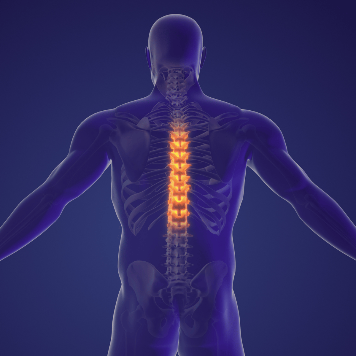 Avoid Long Wait Times for Spinal Fusion Surgery and Discectomy: Choose Mexico