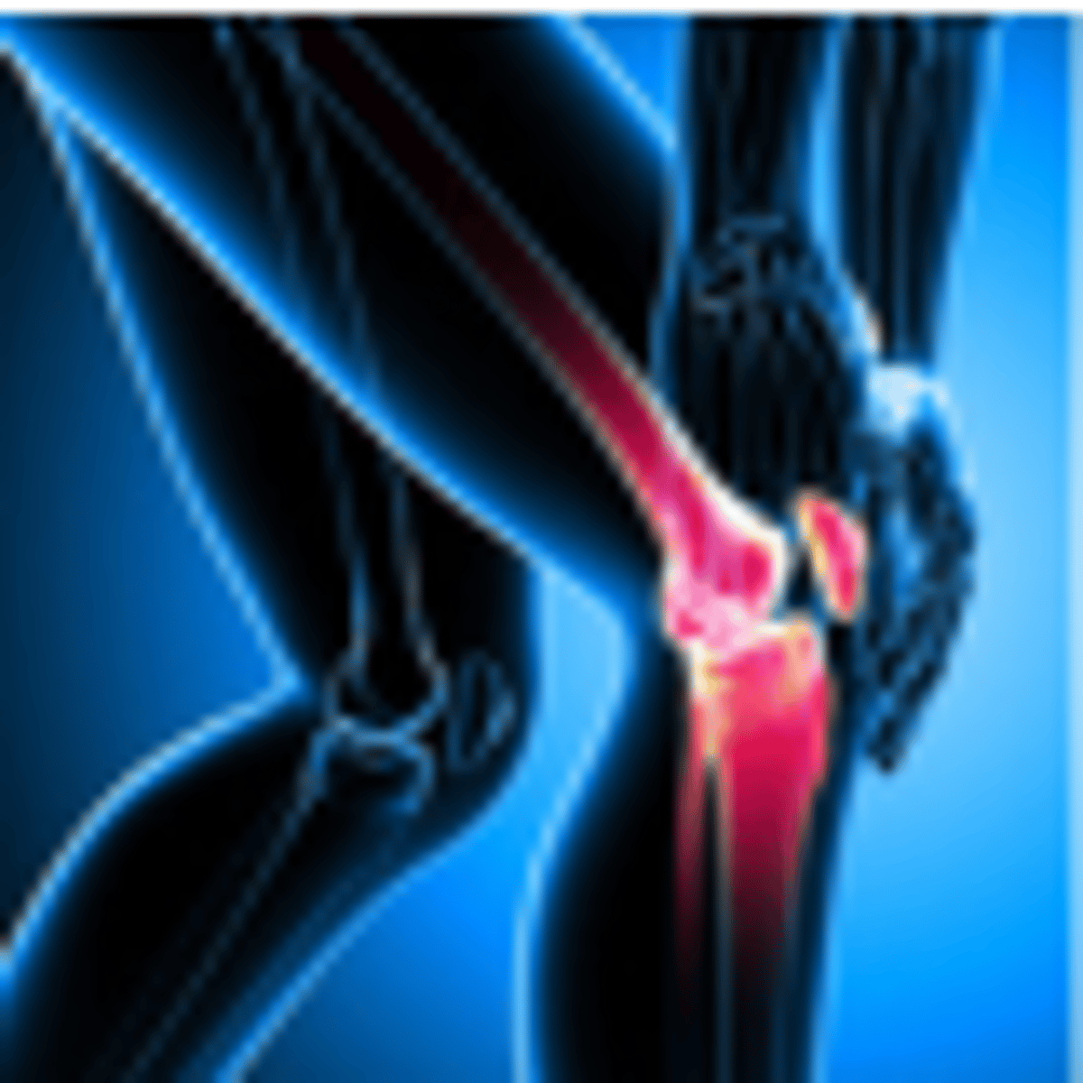 Jiri Melichar’s Stem Cell Therapy Journey: Healing His Knees in Cali, Colombia