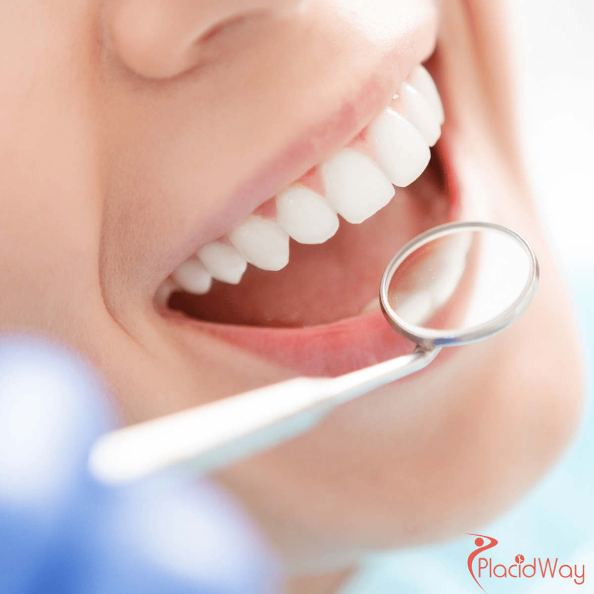 American Patients Opt for Vietnam's High-Quality Dental Procedures