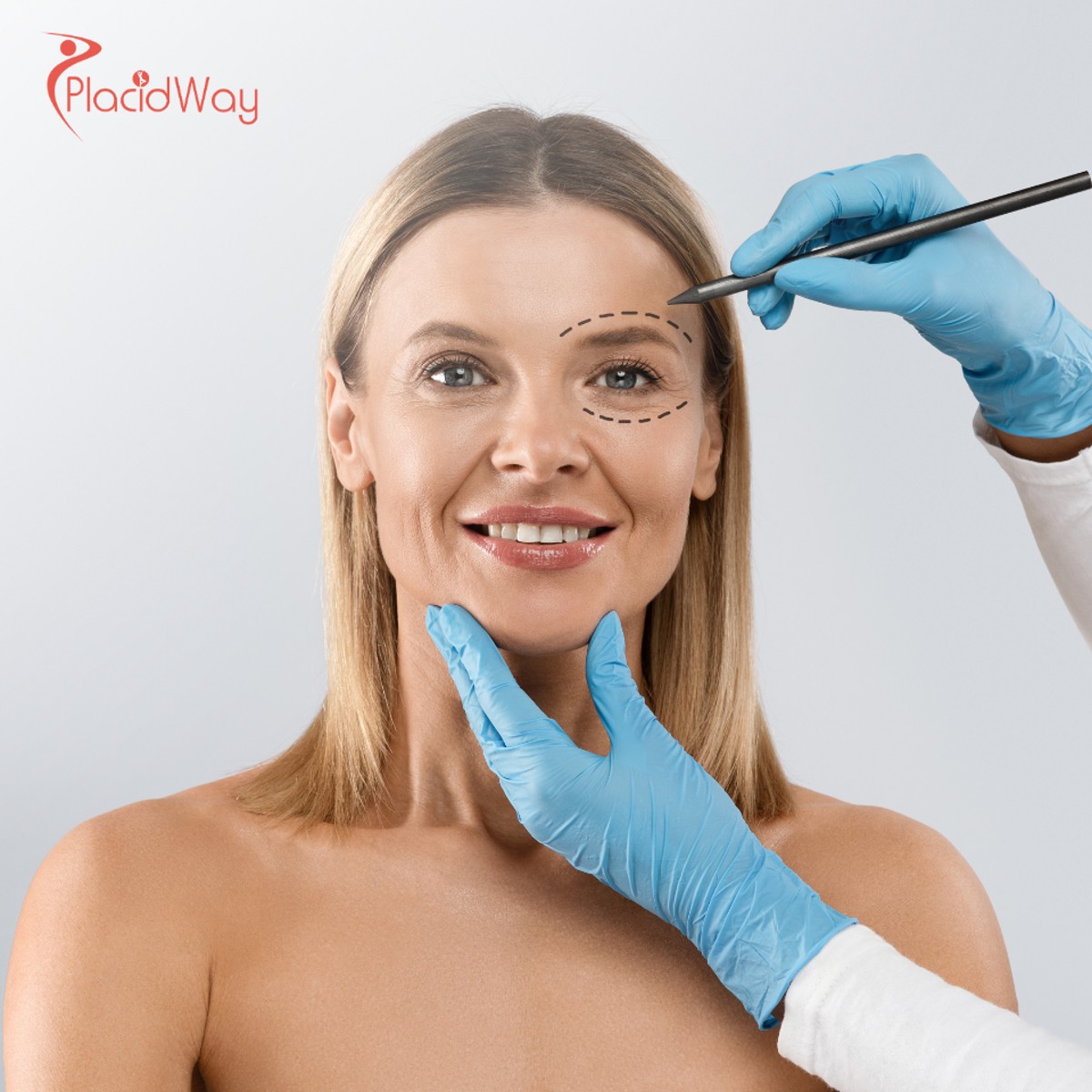 Facial Feminization Surgery in Thailand: Comprehensive Guide for Australian Transgender Patients