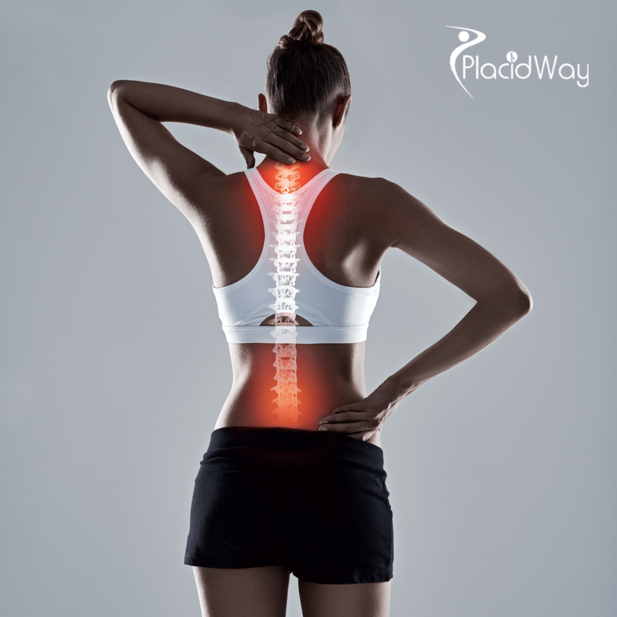 Laminectomy for Spinal Stenosis in Turkey: A Guide for UK Medical Travellers
