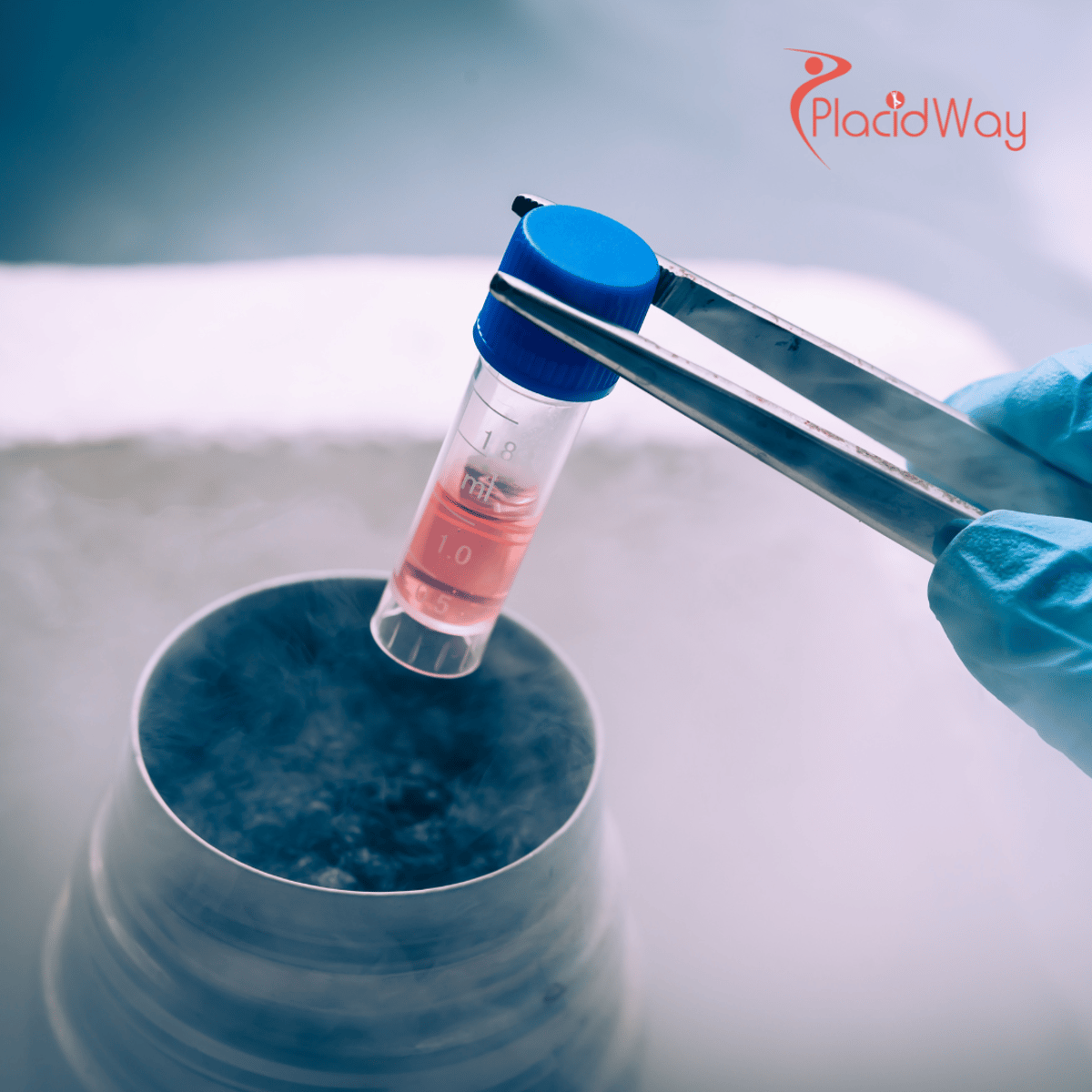 The Cost of Stem Cell Therapy in Turkey: A Detailed Price Breakdown for UK Patients