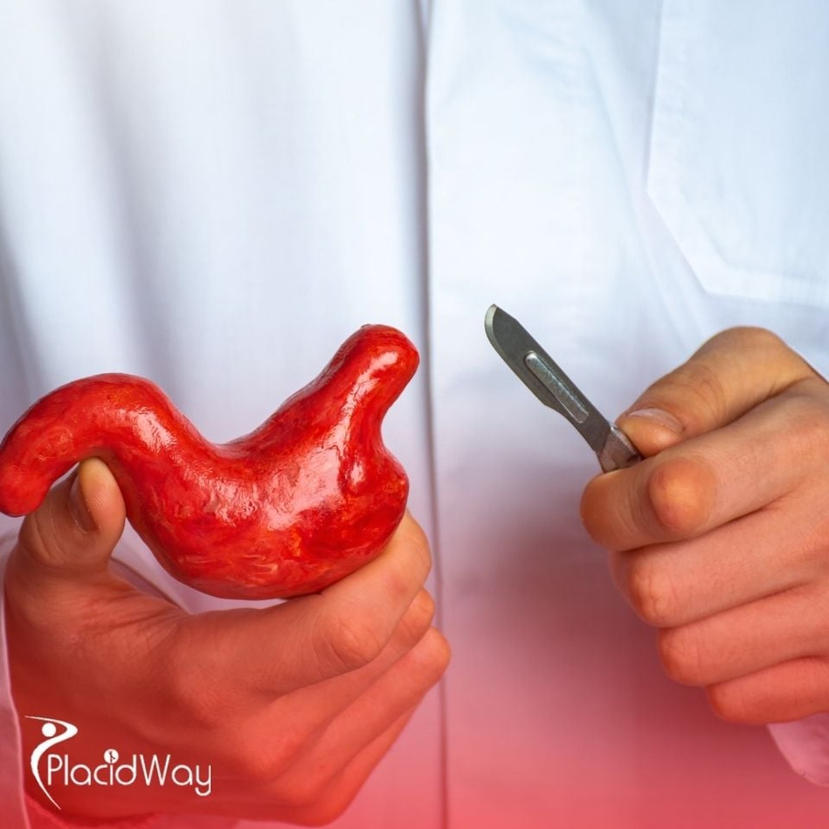Choosing a Bariatric Surgeon in Turkey: A Checklist for UK Medical Tourists