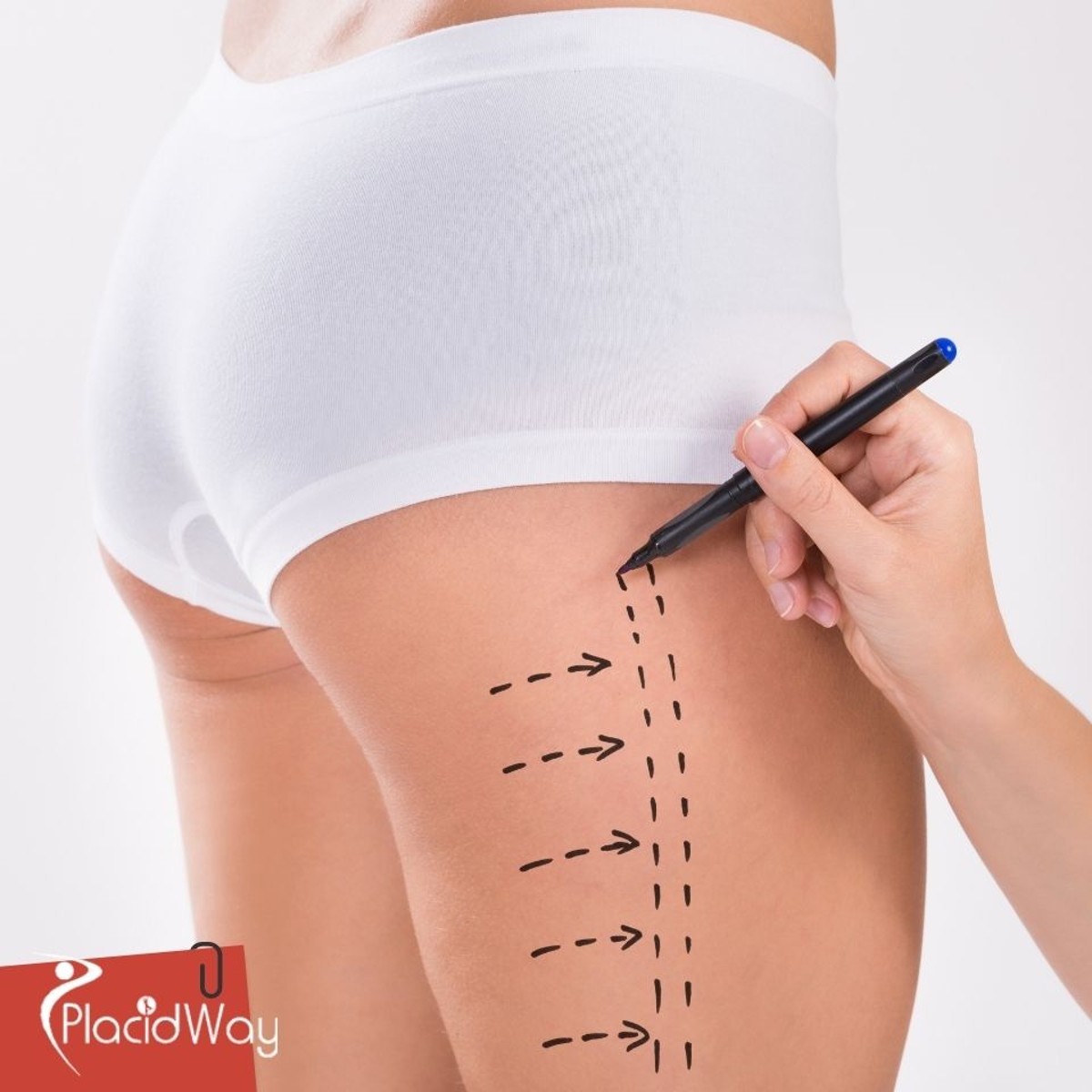 Liposuction in Colombia: Affordable Body Sculpting for Texas Patients