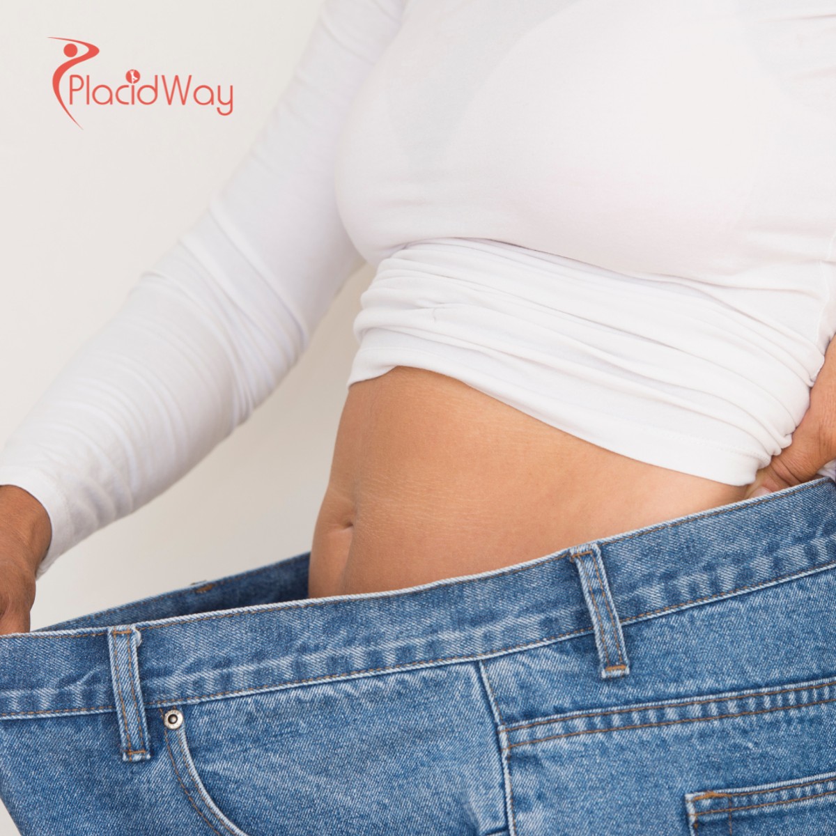 Gastric Bypass Surgery in Turkey: Why German Tourists Choose Roux-en-Y for Lasting Weight Loss